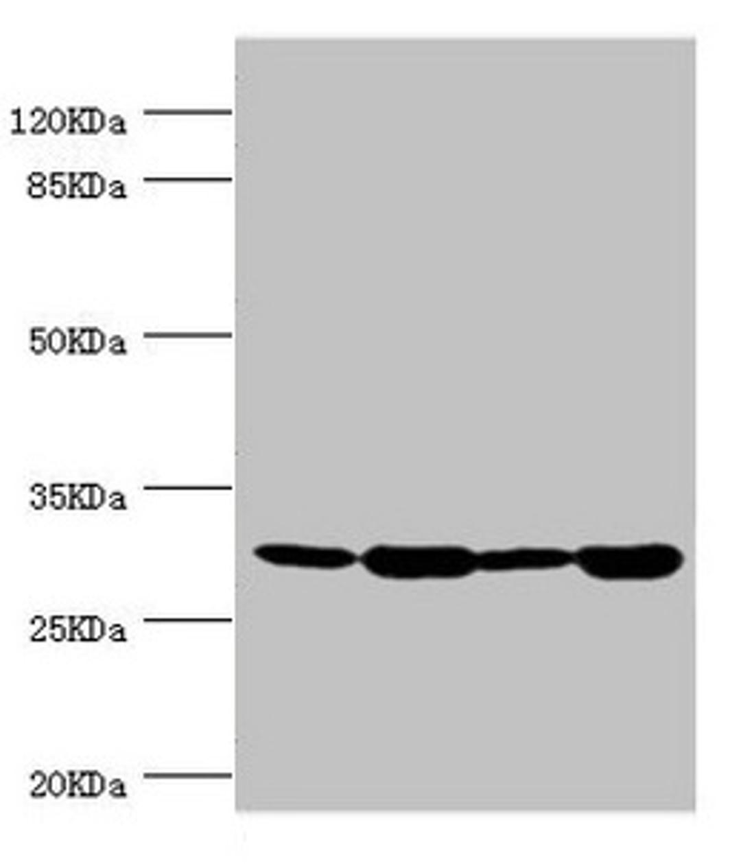 Western blot. All lanes: BCAP29 antibody at 2.93µg/ml. Lane 1: Raji whole cell lysate. Lane 2: Colo320 whole cell lysate. Lane 3: Rat gonad tissue. Lane 4: THP-1 whole cell lysate. Secondary. Goat polyclonal to rabbit IgG at 1/10000 dilution. Predicted band size: 29, 41 kDa. Observed band size: 29 kDa