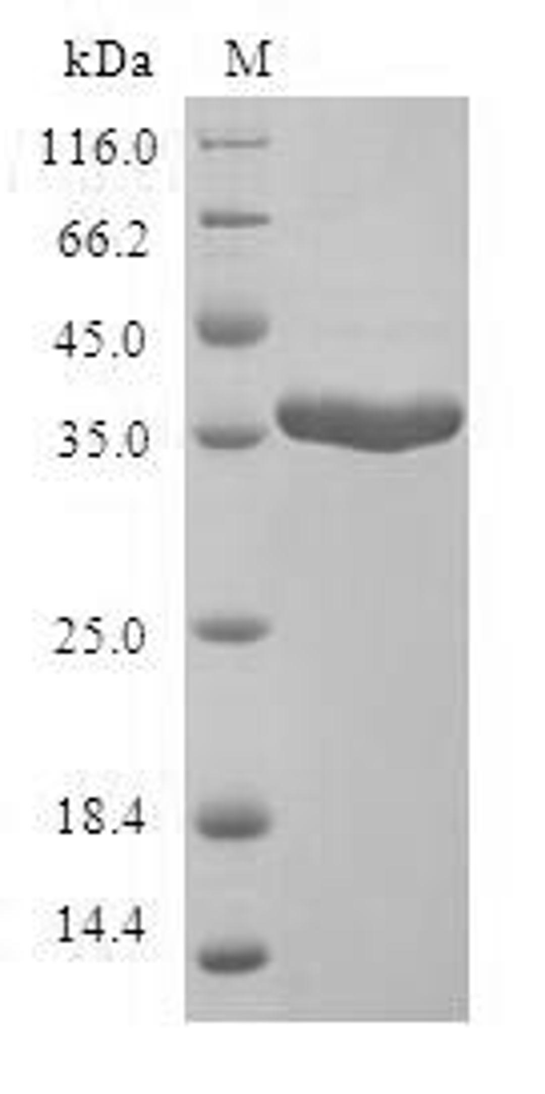 (Tris-Glycine gel) Discontinuous SDS-PAGE (reduced) with 5% enrichment gel and 15% separation gel.