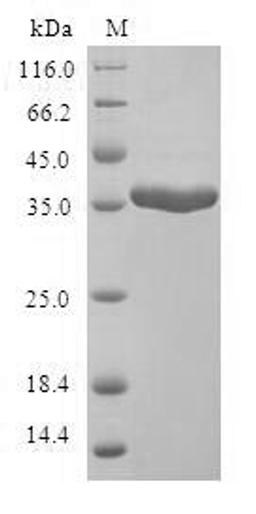 (Tris-Glycine gel) Discontinuous SDS-PAGE (reduced) with 5% enrichment gel and 15% separation gel.