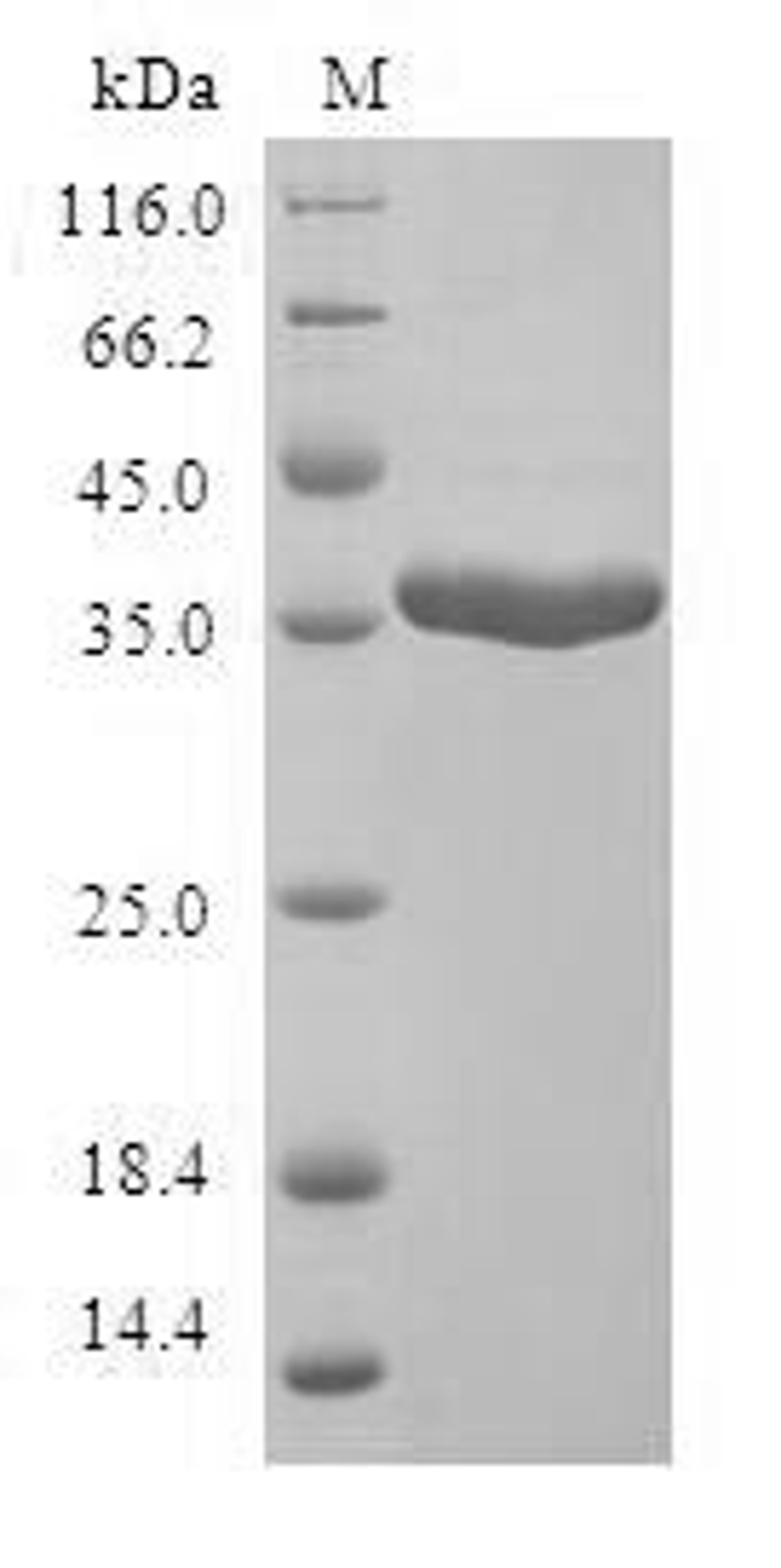 (Tris-Glycine gel) Discontinuous SDS-PAGE (reduced) with 5% enrichment gel and 15% separation gel.