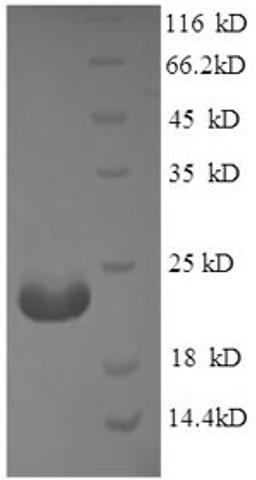 (Tris-Glycine gel) Discontinuous SDS-PAGE (reduced) with 5% enrichment gel and 15% separation gel.