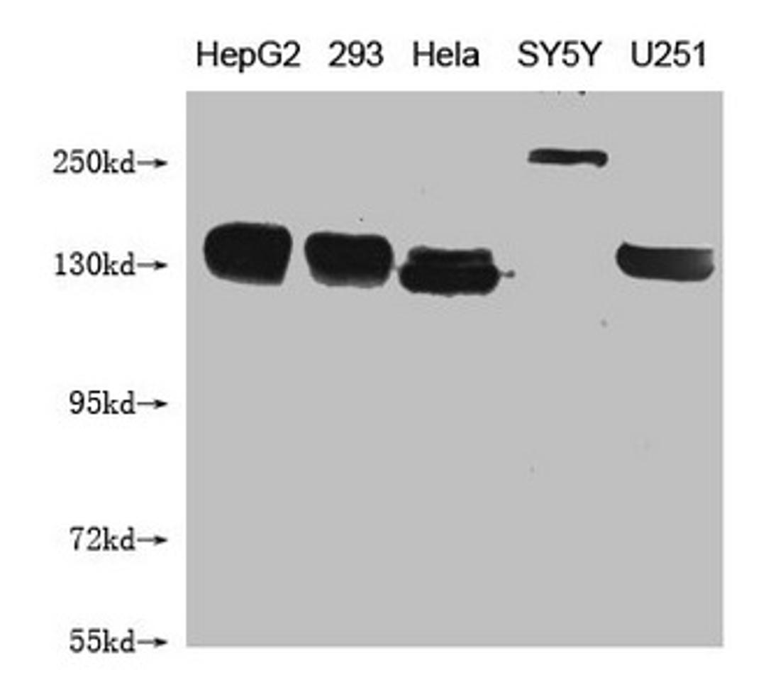 Western Blot. Positive WB detected in: HepG2 whole cell lysate, 293 whole cell lysate, Hela whole cell lysate, SY5Y whole cell lysate, U251 whole cell lysate . All lanes: ABCB1 antibody at 1:1000. Secondary. Goat polyclonal to mouse IgG at 1/50000 dilution. Predicted band size: 141 kDa. Observed band size: 141-250 KDa. Exposure time：5min