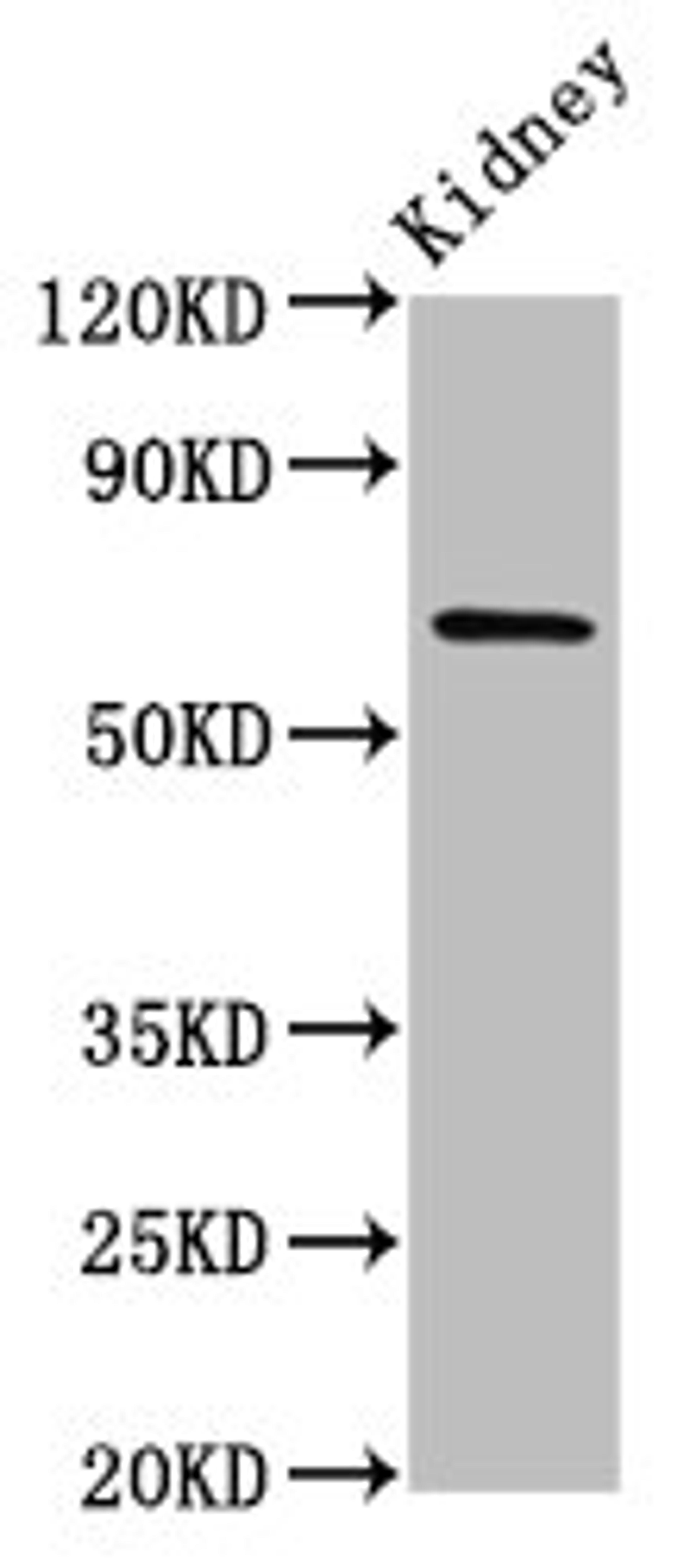 Western Blot. Positive WB detected in: Rat kidney tissue. All lanes: TNIP1 antibody at 7ug/ml. Secondary. Goat polyclonal to rabbit IgG at 1/50000 dilution. Predicted band size: 72, 67, 65, 63, 62 kDa. Observed band size: 72 kDa. 