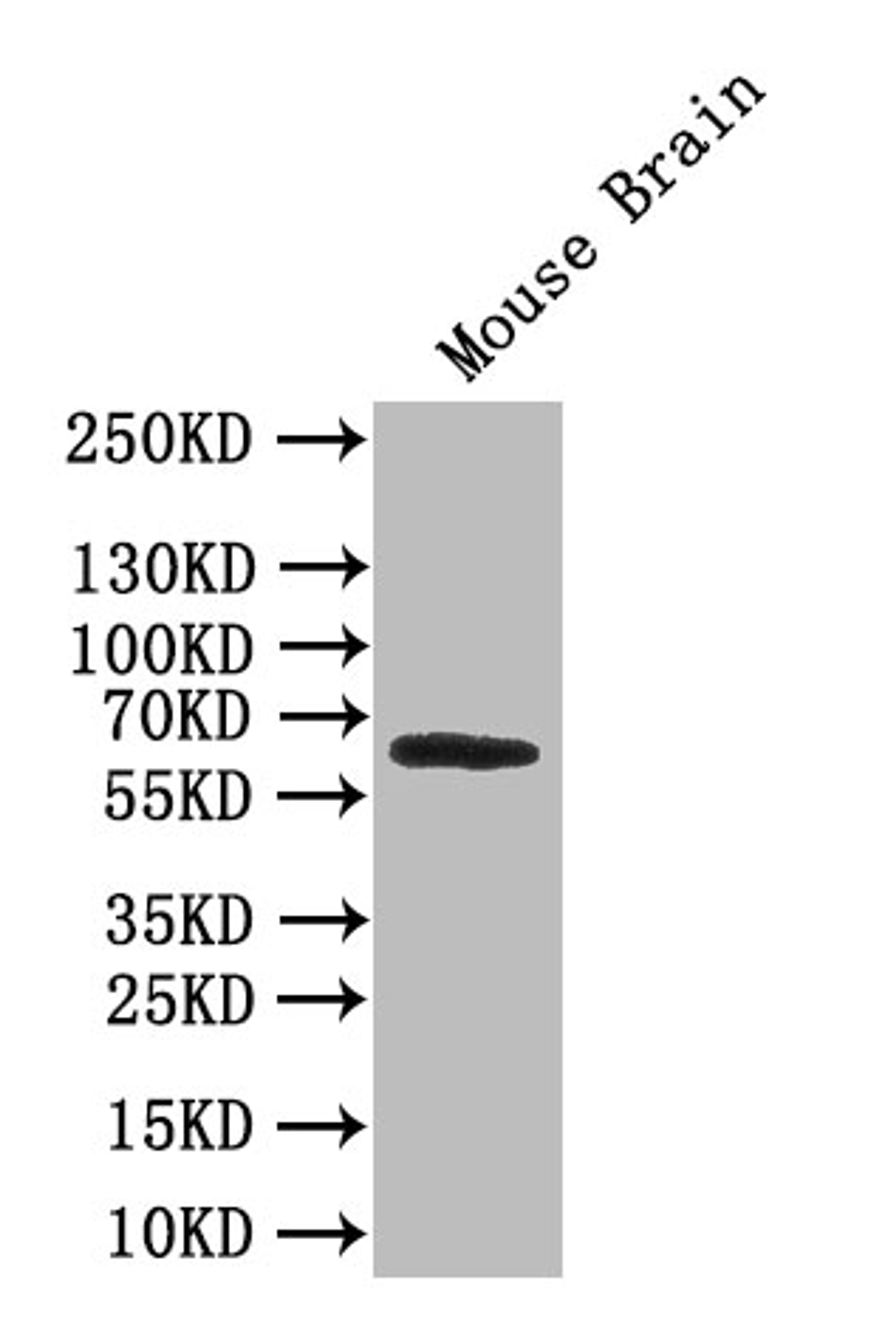 Western Blot. Positive WB detected in: A549 whole cell lysate, Mouse skeletal muscle tissue, Rat lung tissue. All lanes: AOAH antibody at 2.5ug/ml. Secondary. Goat polyclonal to rabbit IgG at 1/50000 dilution. Predicted band size: 66, 62 kDa. Observed band size: 66 kDa. 