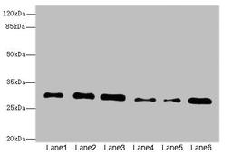 Western blot. All lanes: STX7antibody at 2.39ug/ml. Lane 1: Mouse brain tissue. Lane 2: Mouse spleen tissue. Lane 3: Hela whole cell lysate. Lane 4: Jurkat whole cell lysate. Lane 5: NIH/3T3 whole cell lysate. Lane 6: HepG2 whole cell lysate. Secondary. Goat polyclonal to rabbit IgG at 1/10000 dilution. Predicted band size: 30, 28 kDa. Observed band size: 30 kDa. 