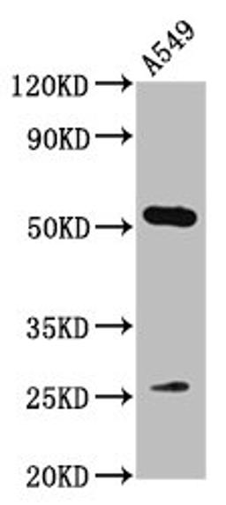 Western Blot. Positive WB detected in: A549 whole cell lysate. All lanes: MICU1 antibody at 3.2µg/ml. Secondary. Goat polyclonal to rabbit IgG at 1/50000 dilution. Predicted band size: 55, 46, 33, 32 kDa. Observed band size: 55 kDa