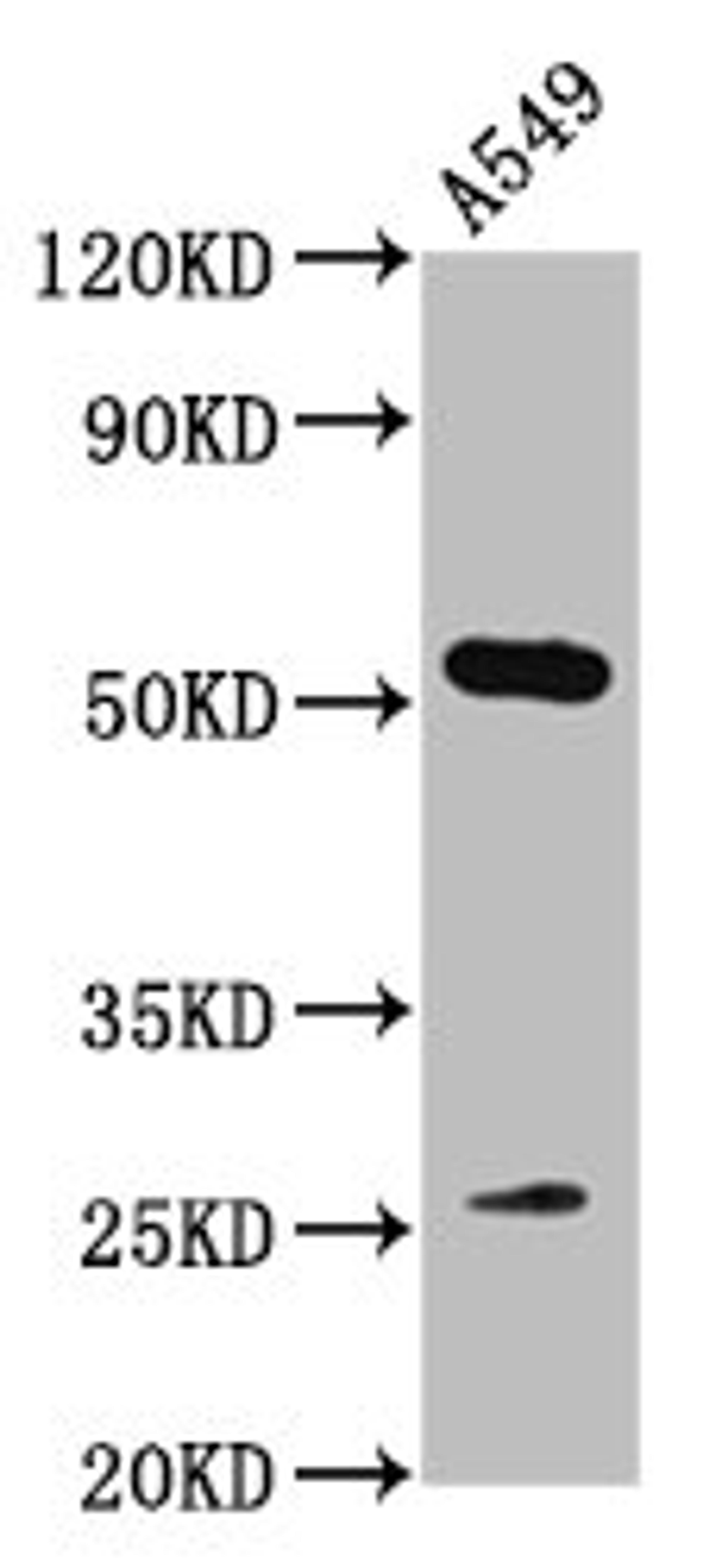 Western Blot. Positive WB detected in: A549 whole cell lysate. All lanes: MICU1 antibody at 3.2µg/ml. Secondary. Goat polyclonal to rabbit IgG at 1/50000 dilution. Predicted band size: 55, 46, 33, 32 kDa. Observed band size: 55 kDa