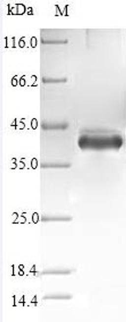 (Tris-Glycine gel) Discontinuous SDS-PAGE (reduced) with 5% enrichment gel and 15% separation gel.