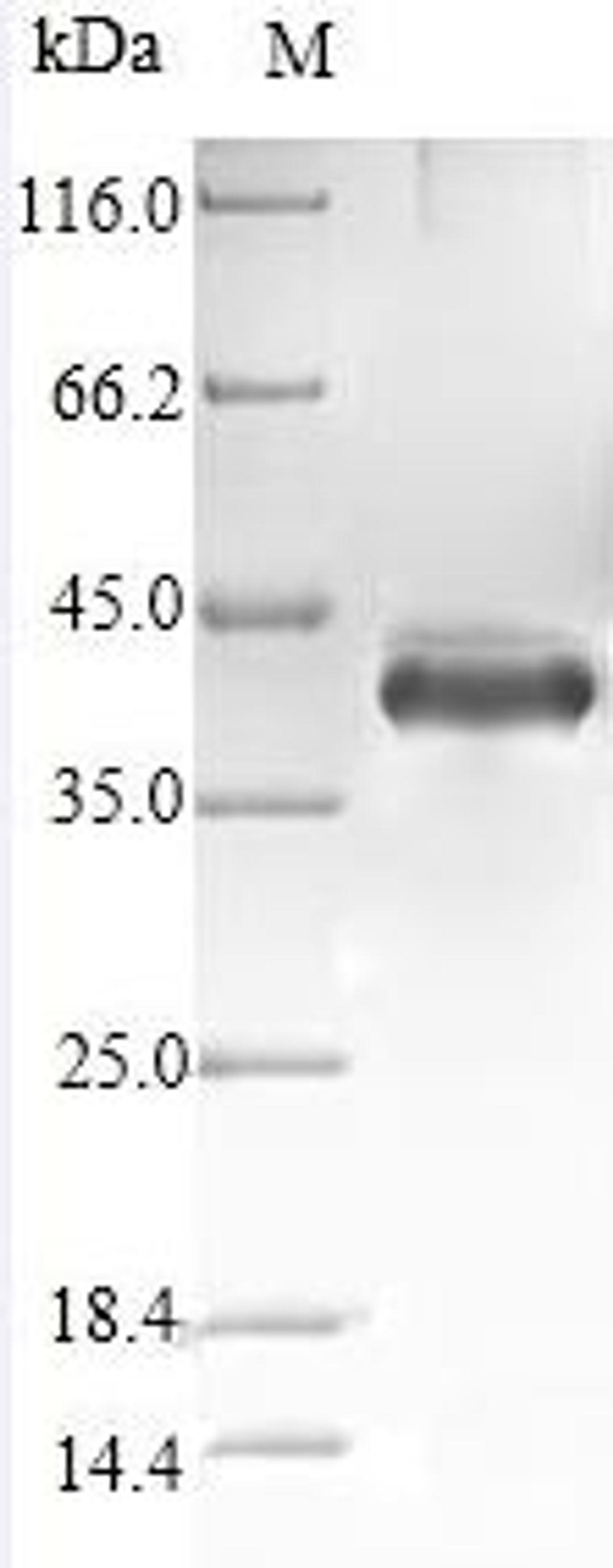 (Tris-Glycine gel) Discontinuous SDS-PAGE (reduced) with 5% enrichment gel and 15% separation gel.
