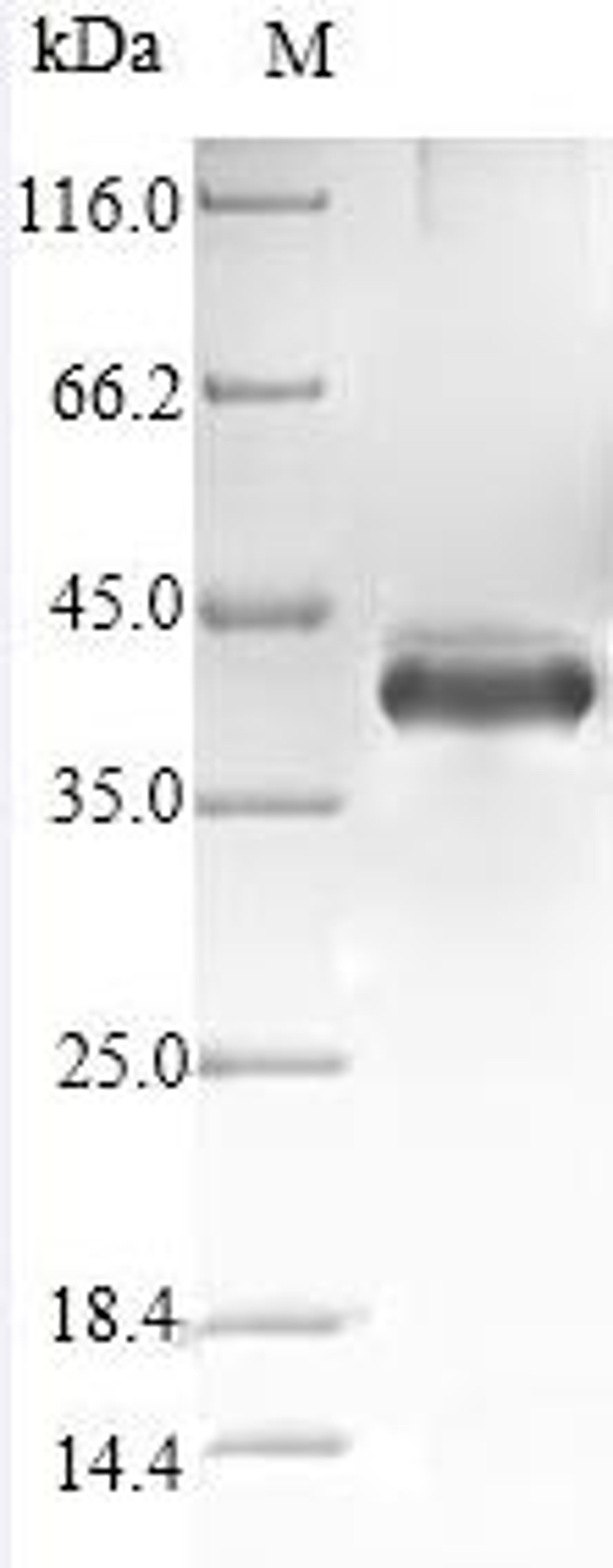 (Tris-Glycine gel) Discontinuous SDS-PAGE (reduced) with 5% enrichment gel and 15% separation gel.