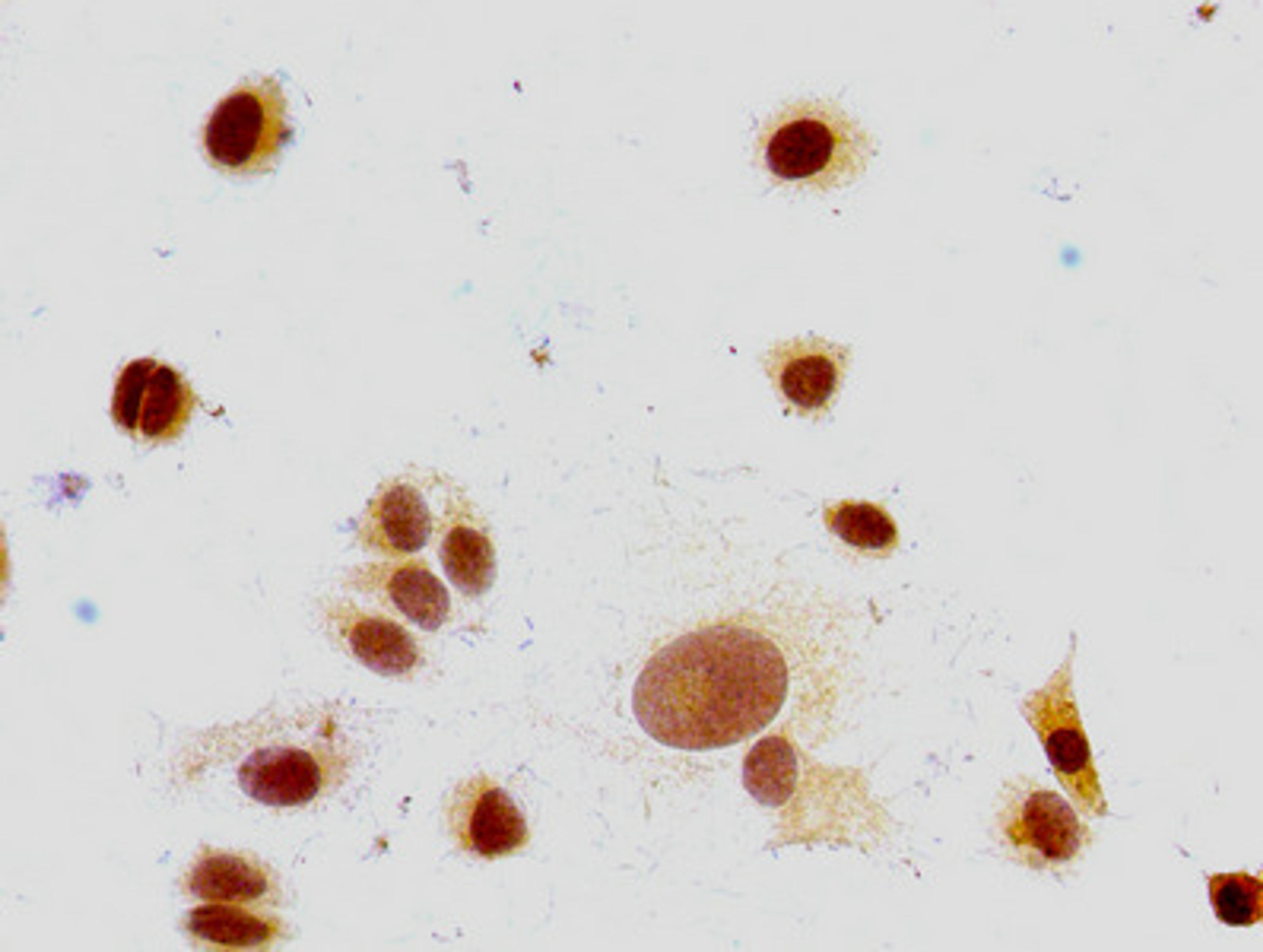 Immunocytochemistry analysis of MCF-7 cells using CSB-PA010380PA147me1HU at dilution of 1:100