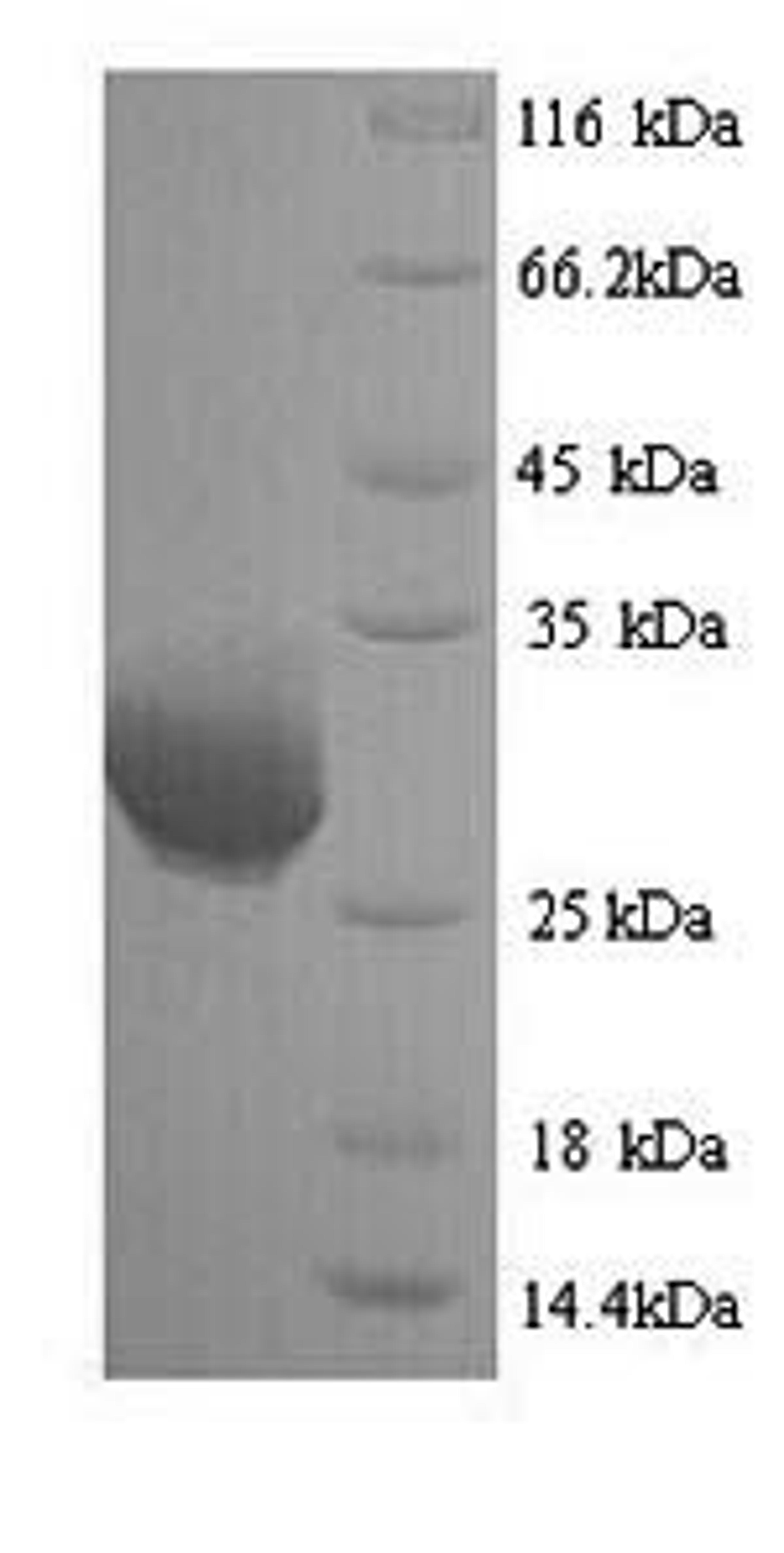 (Tris-Glycine gel) Discontinuous SDS-PAGE (reduced) with 5% enrichment gel and 15% separation gel.