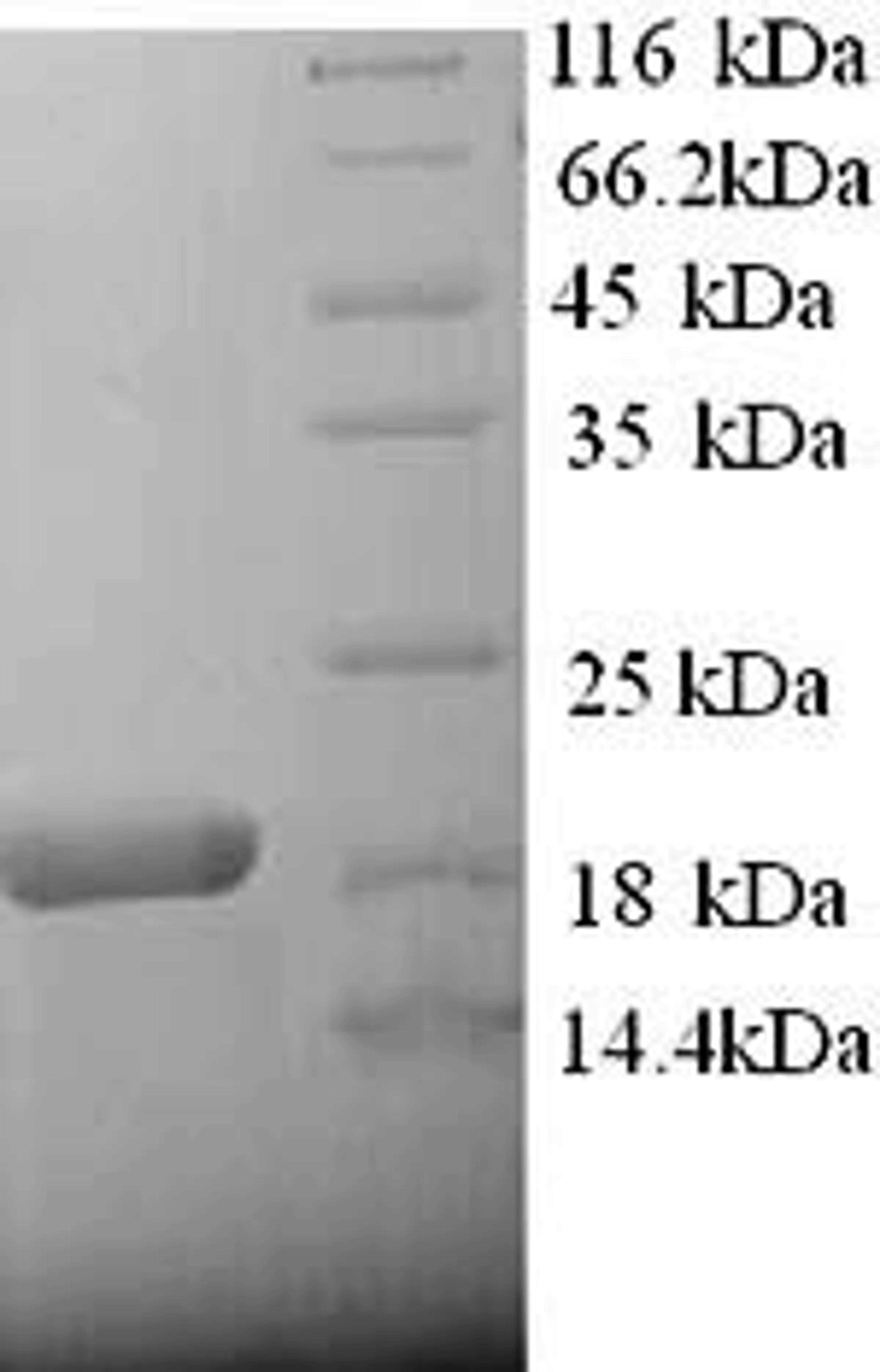 (Tris-Glycine gel) Discontinuous SDS-PAGE (reduced) with 5% enrichment gel and 15% separation gel.