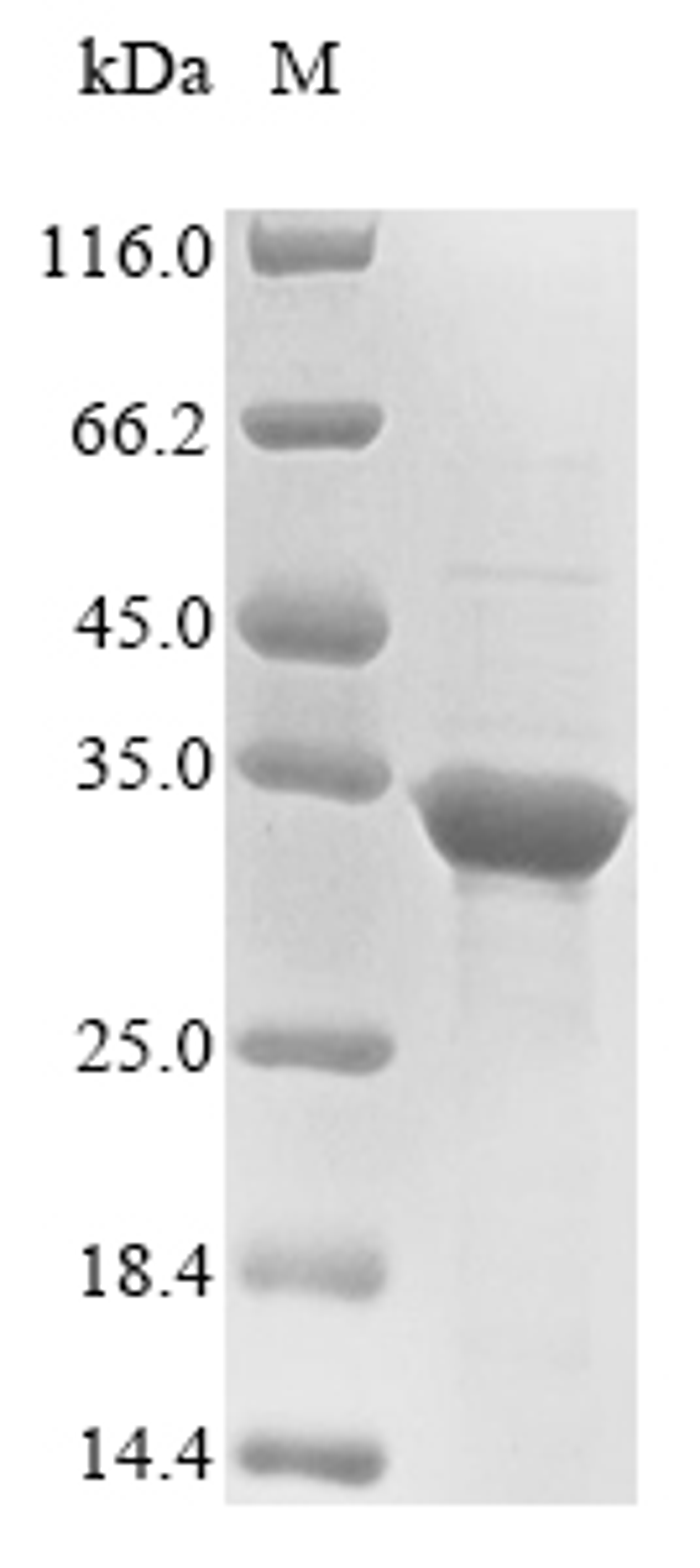 (Tris-Glycine gel) Discontinuous SDS-PAGE (reduced) with 5% enrichment gel and 15% separation gel.
