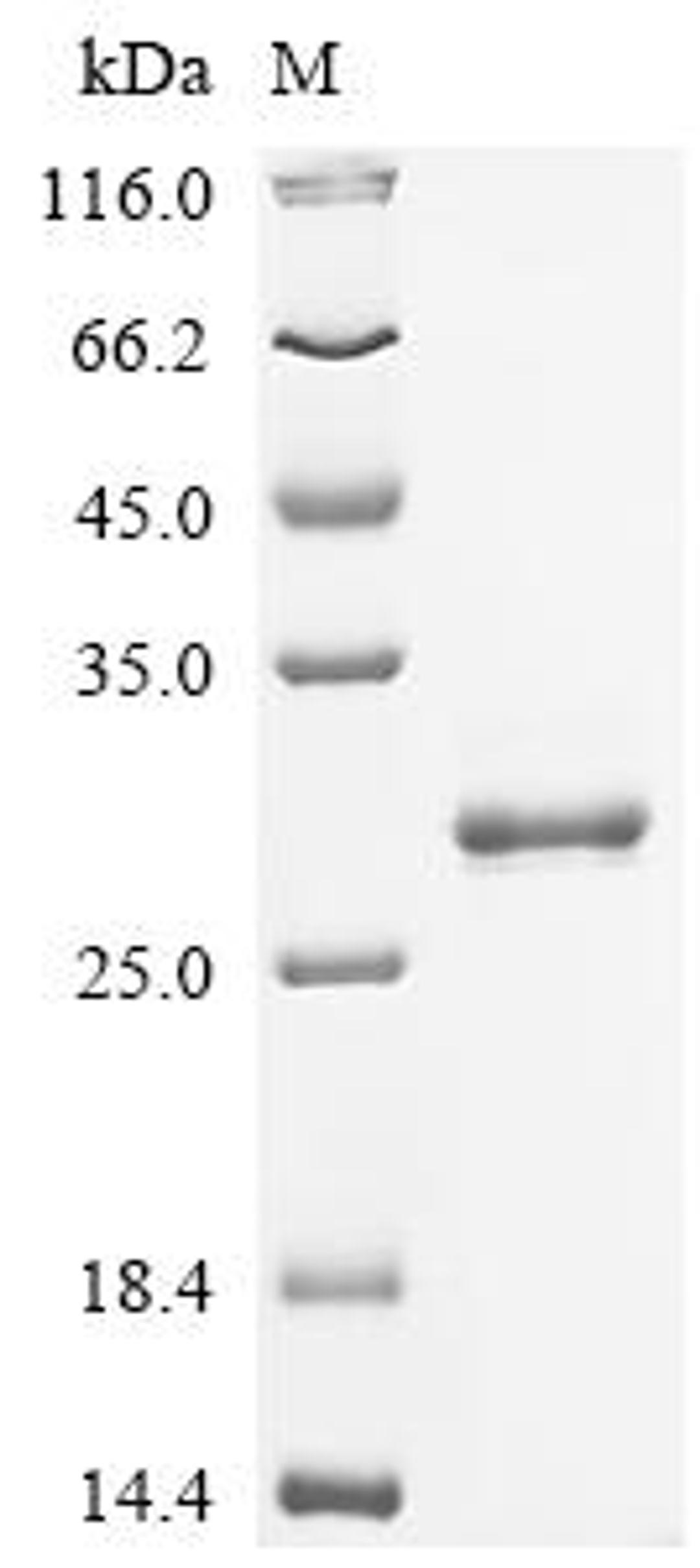 (Tris-Glycine gel) Discontinuous SDS-PAGE (reduced) with 5% enrichment gel and 15% separation gel.