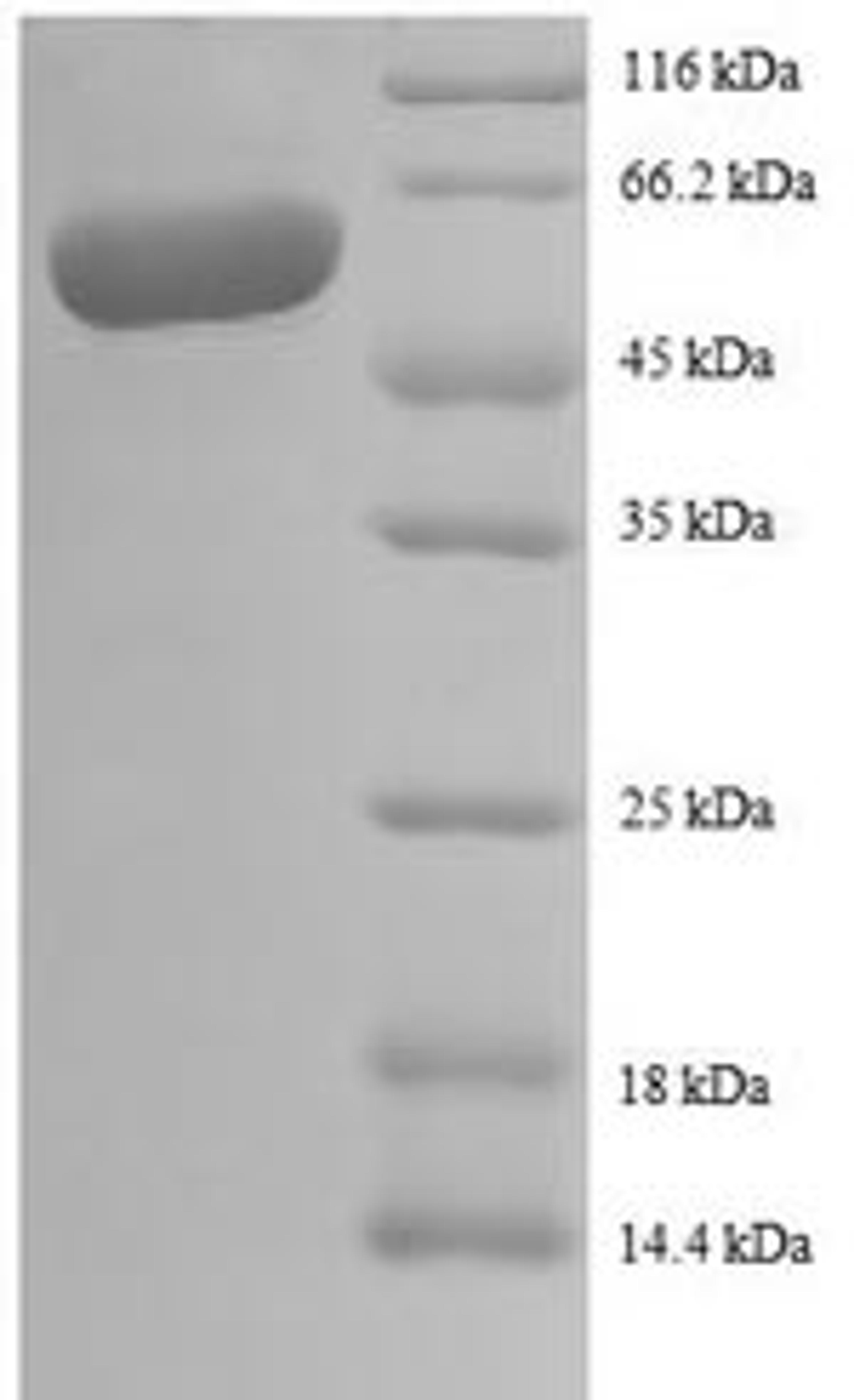 (Tris-Glycine gel) Discontinuous SDS-PAGE (reduced) with 5% enrichment gel and 15% separation gel.