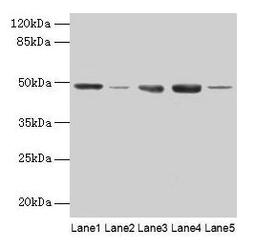 Western blot. All lanes: FNTB antibody at 6µg/ml. Lane 1: Hela whole cell lysate. Lane 2: CEM whole cell lysate. Lane 3: HepG2 whole cell lysate. Lane 4: SH-SY5Y whole cell lysate. Lane 5: A549 whole cell lysate. Secondary. Goat polyclonal to rabbit IgG at 1/10000 dilution. Predicted band size: 49, 44 kDa. Observed band size: 49 kDa