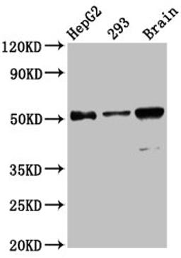 Western Blot. Positive WB detected in: HepG2 whole cell lysate, 293 whole cell lysate, Mouse brain tissue. All lanes: ZFP57 antibody at 13.6µg/ml. Secondary. Goat polyclonal to rabbit IgG at 1/50000 dilution. Predicted band size: 52, 60, 62 kDa. Observed band size: 52 kDa