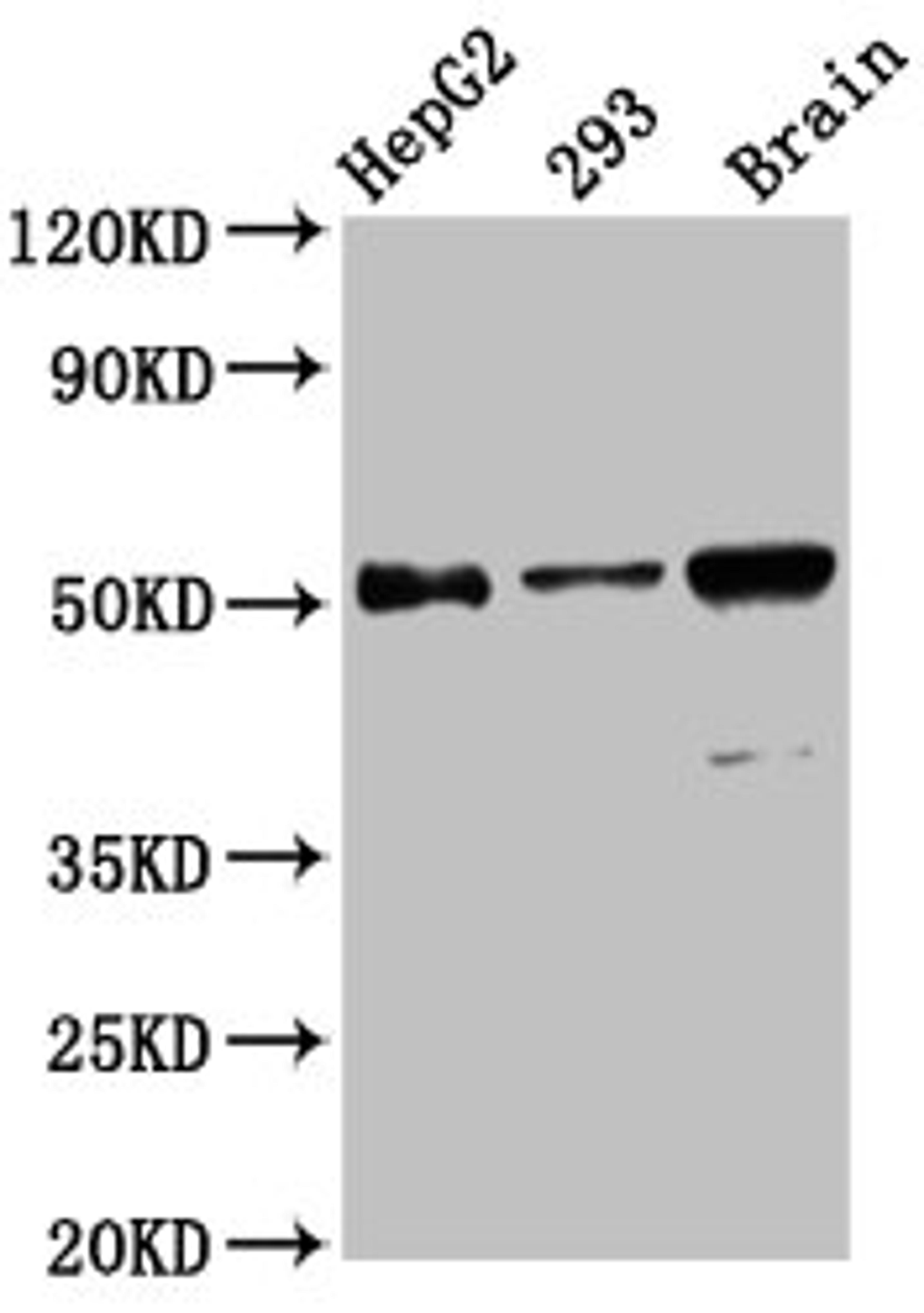 Western Blot. Positive WB detected in: HepG2 whole cell lysate, 293 whole cell lysate, Mouse brain tissue. All lanes: ZFP57 antibody at 13.6µg/ml. Secondary. Goat polyclonal to rabbit IgG at 1/50000 dilution. Predicted band size: 52, 60, 62 kDa. Observed band size: 52 kDa