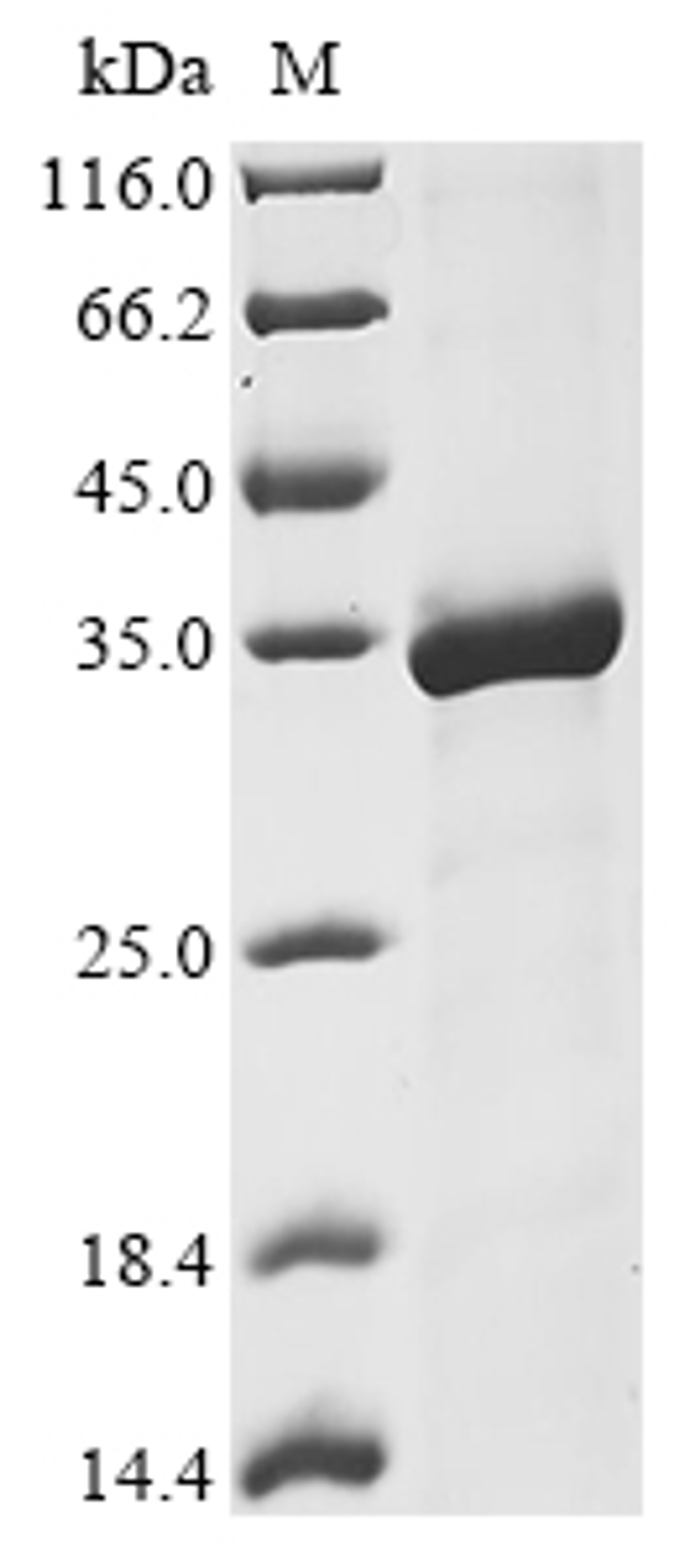 (Tris-Glycine gel) Discontinuous SDS-PAGE (reduced) with 5% enrichment gel and 15% separation gel.