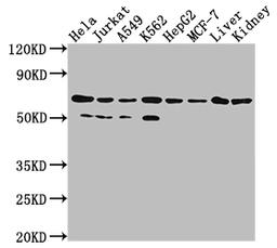 Western Blot. Positive WB detected in: Hela whole cell lysate, Jurkat whole cell lysate, A549 whole cell lysate, HepG2 whole cell lysate, MCF-7 whole cell lysate, Rat liver tissue, Rat kidney tissue. All lanes: AIFM1 antibody at 1:2000. Secondary. Goat polyclonal to rabbit IgG at 1/50000 dilution. Predicted band size: 67, 36, 29, 27 kDa. Observed band size: 67 kDa. 