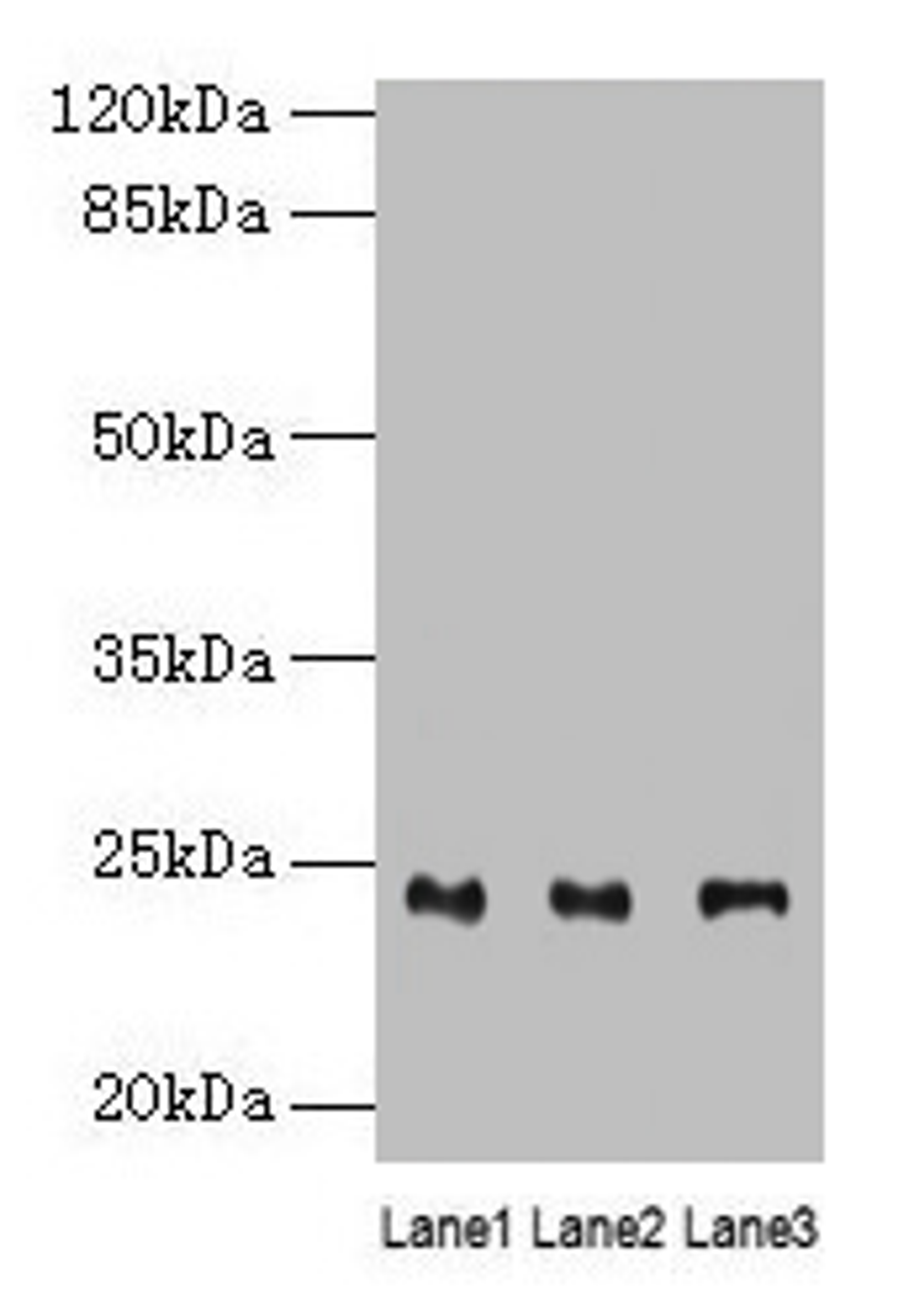 Western blot. All lanes: RAB4B antibody at 4µg/ml. Lane 1: Mouse stomach tissue. Lane 2: Mouse kidney tissue. Lane 3: Mouse gonadal tissue. Secondary. Goat polyclonal to rabbit IgG at 1/10000 dilution. Predicted band size: 24, 28 kDa. Observed band size: 24 kDa