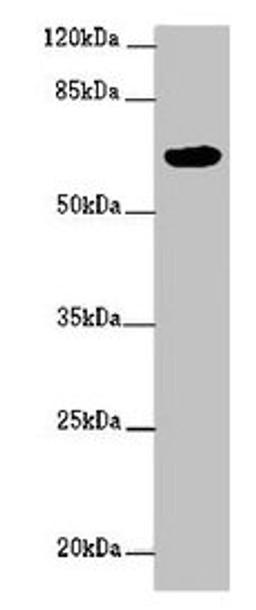 Western blot. All lanes: FBXW5 antibody at 2ug/ml + PC-3 whole cell lysate. Secondary. Goat polyclonal to rabbit IgG at 1/10000 dilution. Predicted band size: 64, 43 kDa. Observed band size: 64 kDa. 