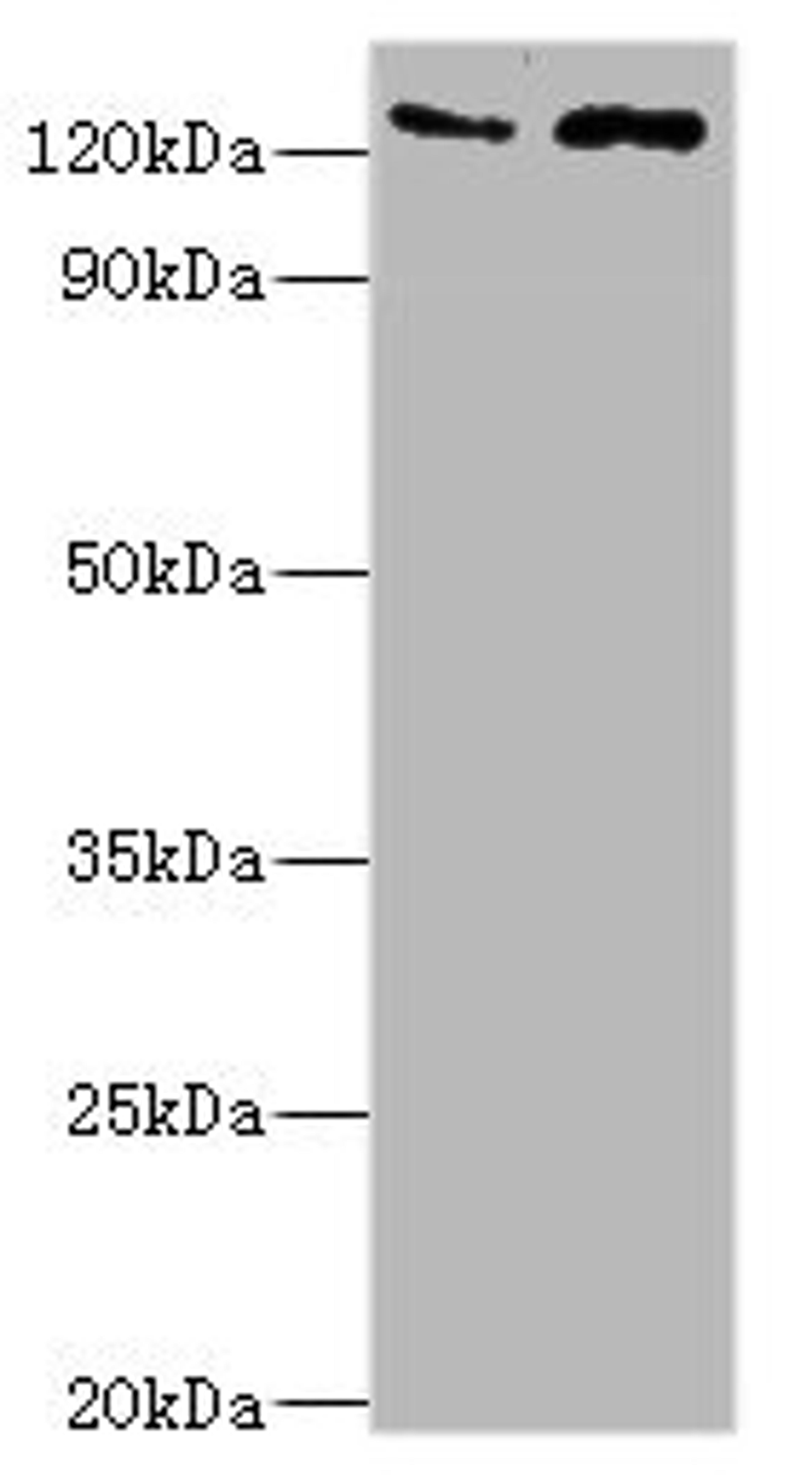 Western blot. All lanes: KDM4B antibody at 4ug/ml. Lane 1: Jurkat whole cell lysate. Lane 2: k562 whole cell lysate. Secondary. Goat polyclonal to rabbit IgG at 1/10000 dilution. Predicted band size: 122, 51 kDa. Observed band size: 122 kDa.