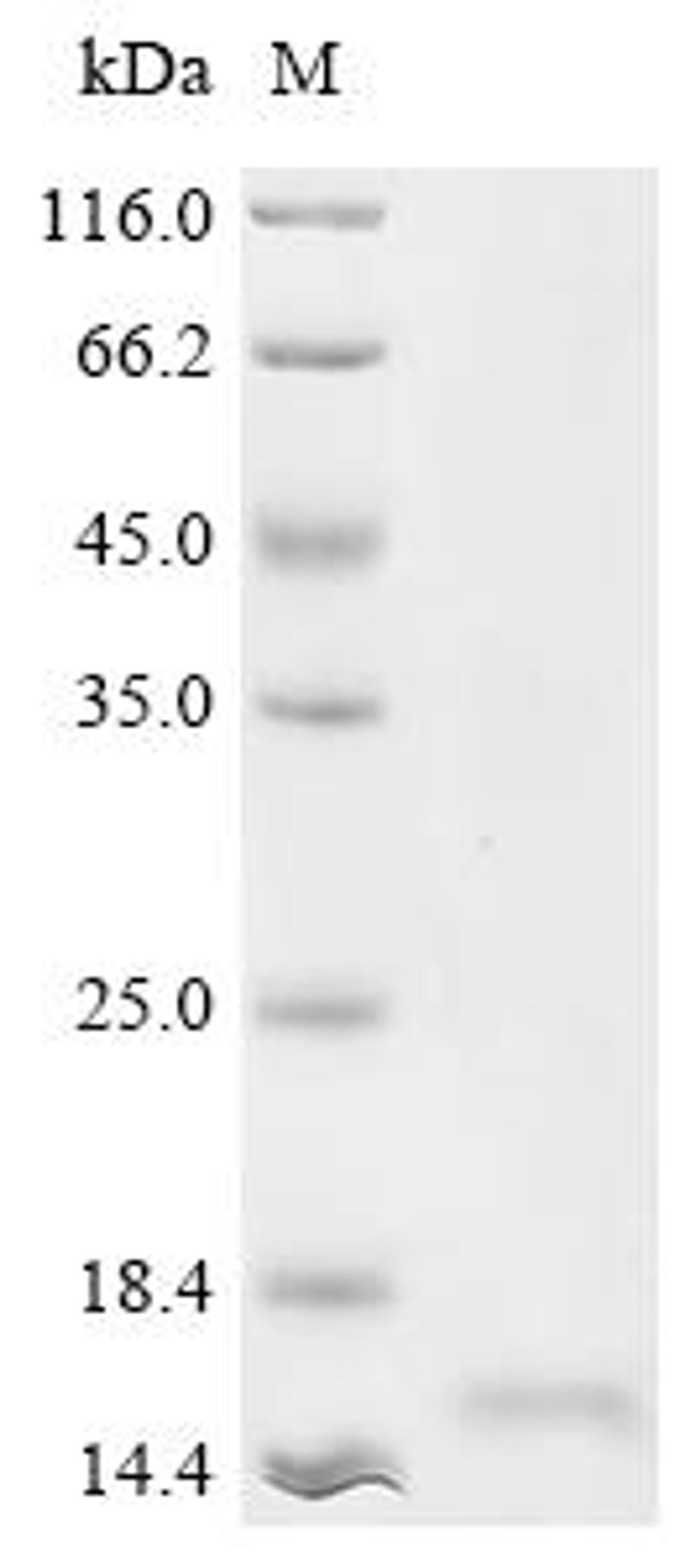 (Tris-Glycine gel) Discontinuous SDS-PAGE (reduced) with 5% enrichment gel and 15% separation gel.