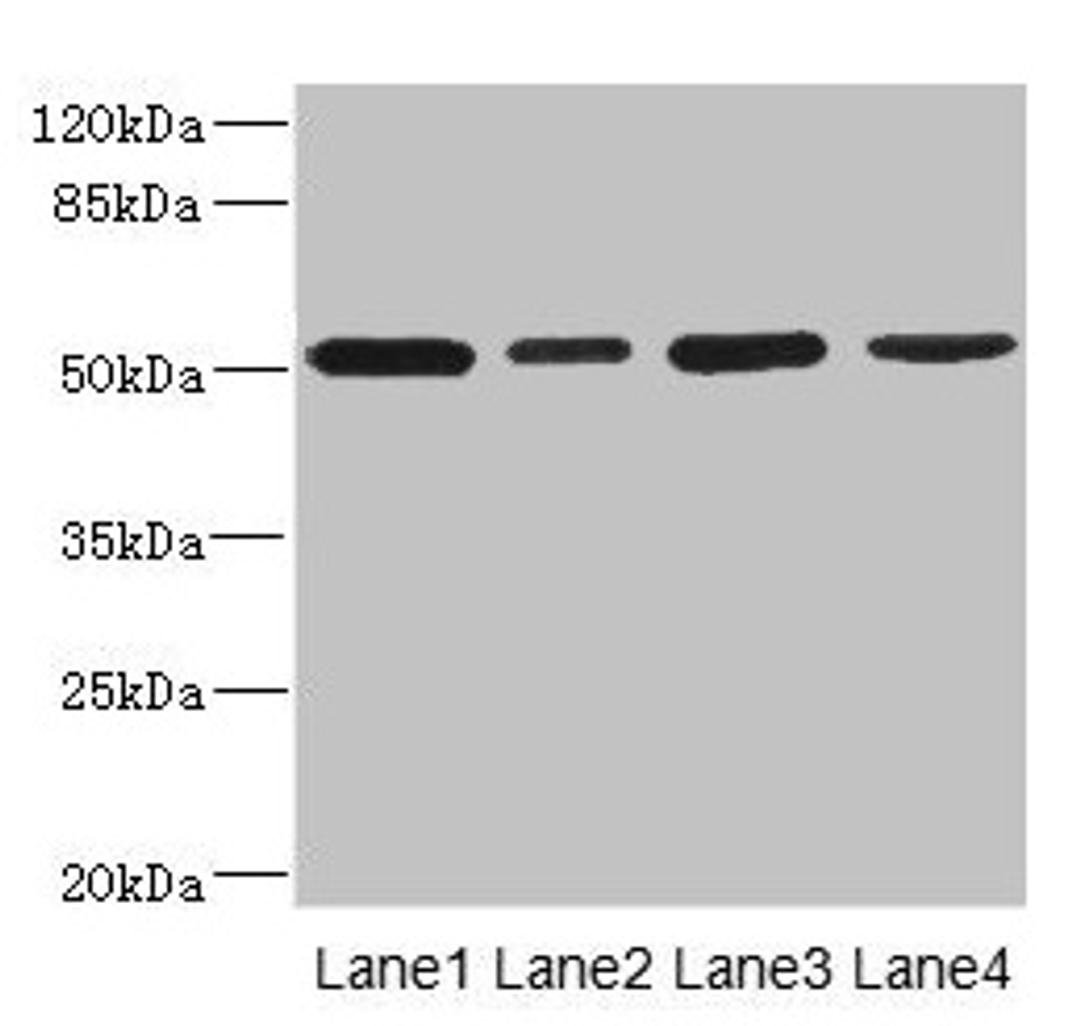 Western blot. All lanes: CD276 antibody at 0.48µg/ml. Lane 1: U251 whole cell lysate. Lane 2: Jurkat whole cell lysate. Lane 3: HepG2 whole cell lysate. Lane 4: 293T whole cell lysate. Secondary. Goat polyclonal to rabbit IgG at 1/10000 dilution. Predicted band size: 58, 34, 53 kDa. Observed band size: 53 kDa