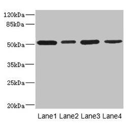 Western blot. All lanes: CD276 antibody at 0.48µg/ml. Lane 1: U251 whole cell lysate. Lane 2: Jurkat whole cell lysate. Lane 3: HepG2 whole cell lysate. Lane 4: 293T whole cell lysate. Secondary. Goat polyclonal to rabbit IgG at 1/10000 dilution. Predicted band size: 58, 34, 53 kDa. Observed band size: 53 kDa