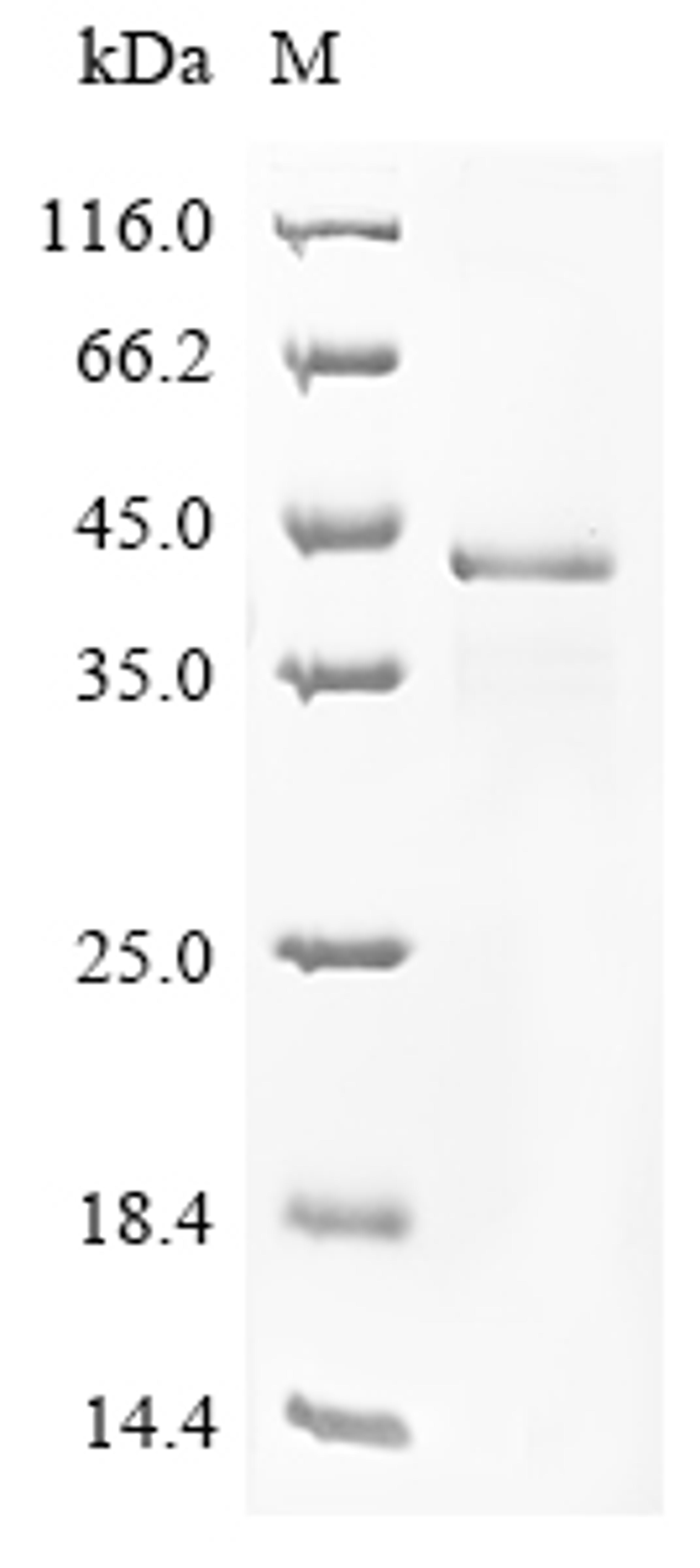 (Tris-Glycine gel) Discontinuous SDS-PAGE (reduced) with 5% enrichment gel and 15% separation gel.
