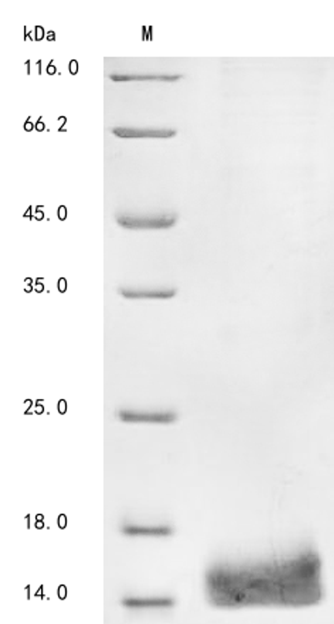 (Tris-Glycine gel) Discontinuous SDS-PAGE (reduced) with 5% enrichment gel and 15% separation gel.