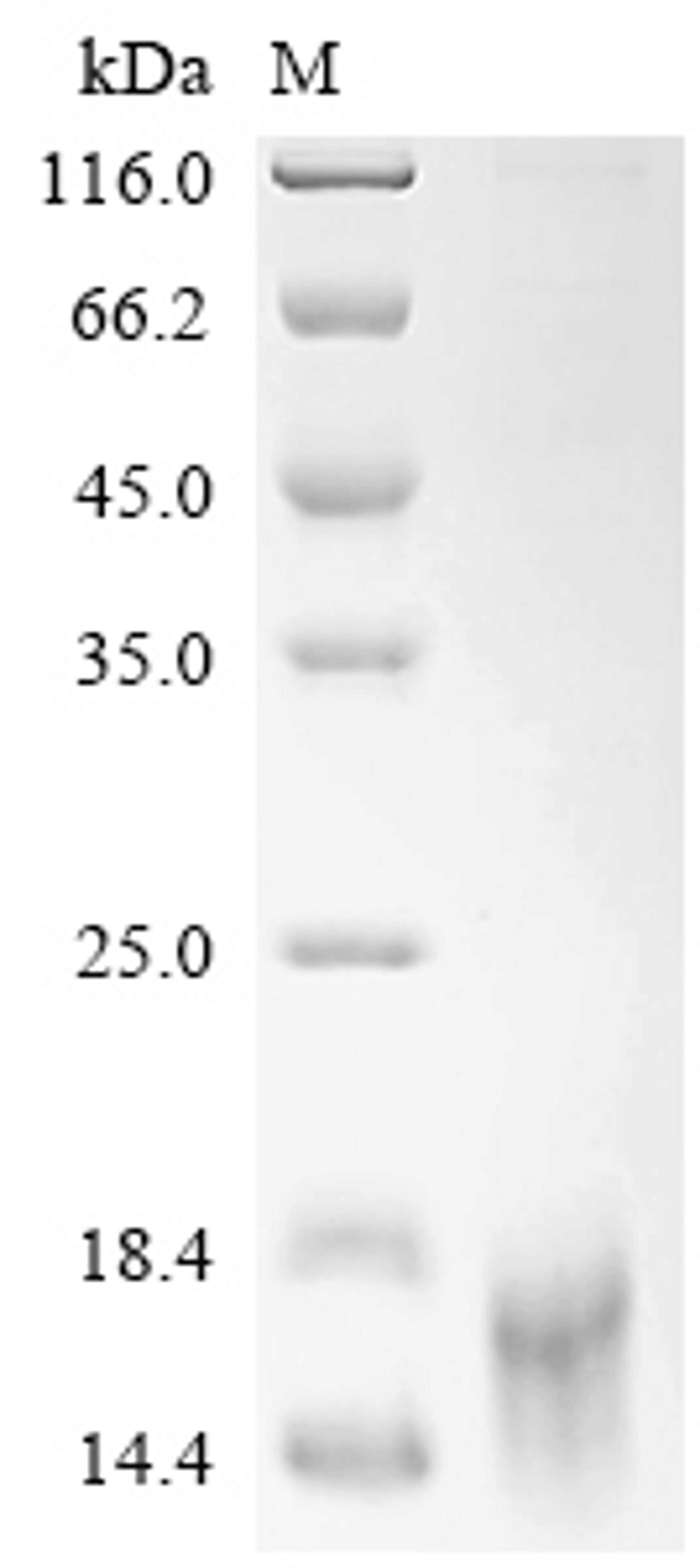 (Tris-Glycine gel) Discontinuous SDS-PAGE (reduced) with 5% enrichment gel and 15% separation gel.