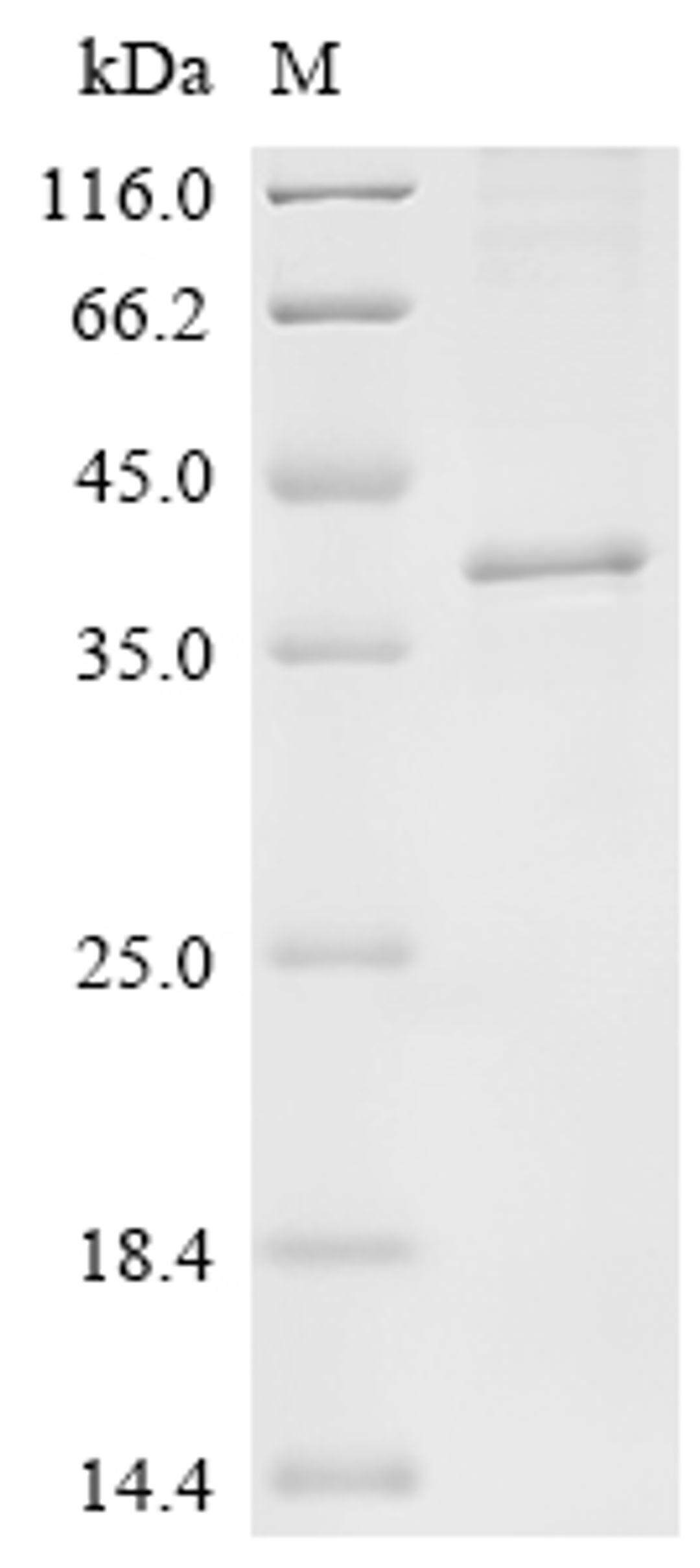 (Tris-Glycine gel) Discontinuous SDS-PAGE (reduced) with 5% enrichment gel and 15% separation gel.