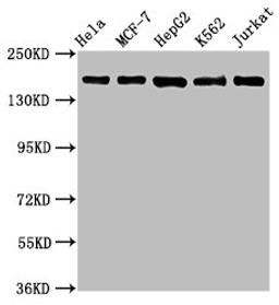 Western Blot. Positive WB detected in: Hela whole cell lysate, MCF-7 whole cell lysate, HepG2 whole cell lysate, K562 whole cell lysate, Jurkat whole cell lysate. All lanes: HDAC6 antibody at 1.1μg/ml. Secondary. Goat polyclonal to rabbit IgG at 1/50000 dilution. Predicted band size: 132, 115 KDa. Observed band size: 160 KDa. 