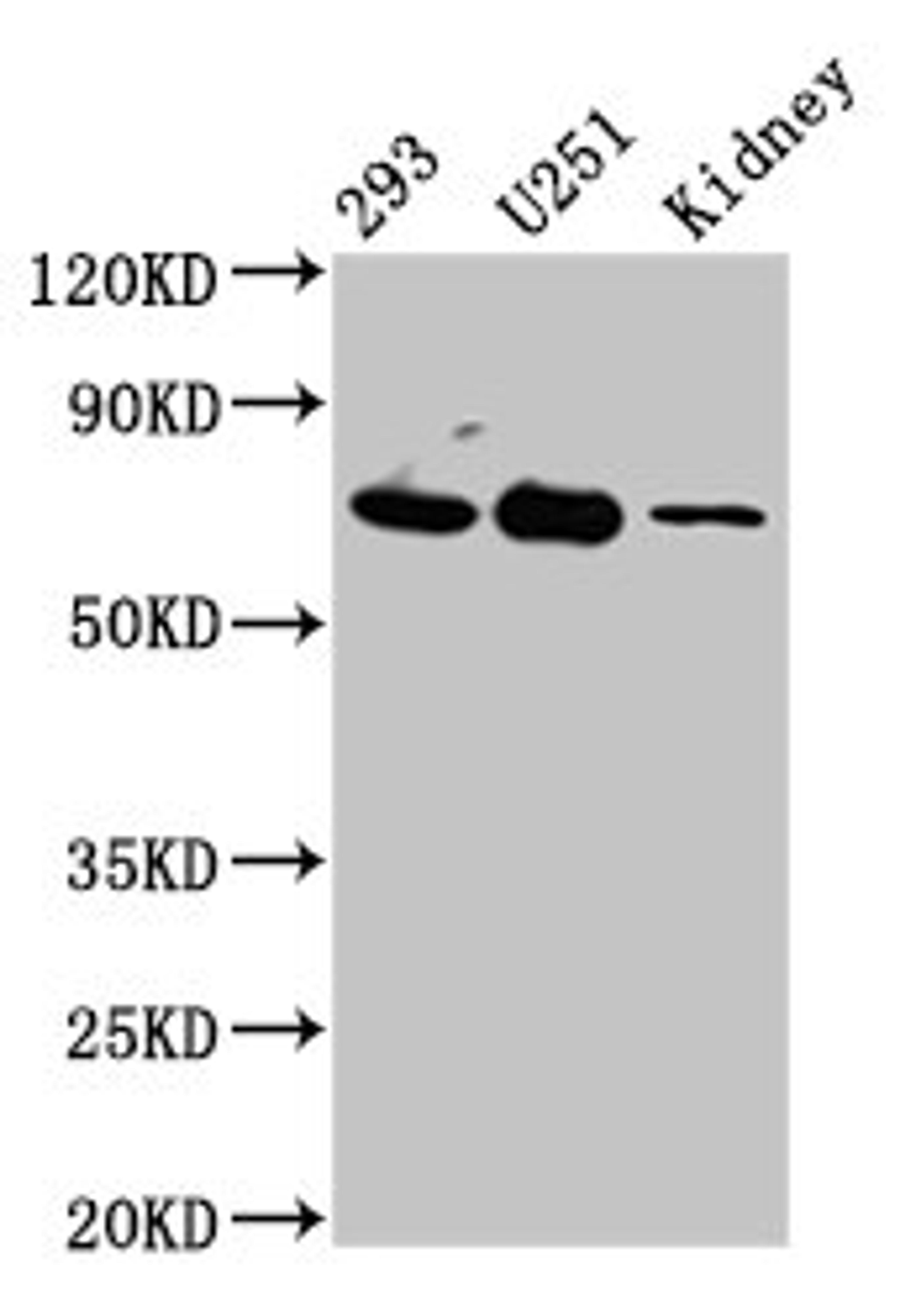 Western Blot. Positive WB detected in: 293 whole cell lysate, U251 whole cell lysate, Rat kidney tissue. All lanes: EOMES antibody at 4.5µg/ml. Secondary. Goat polyclonal to rabbit IgG at 1/50000 dilution. Predicted band size: 73, 48, 46, 75 kDa. Observed band size: 73 kDa