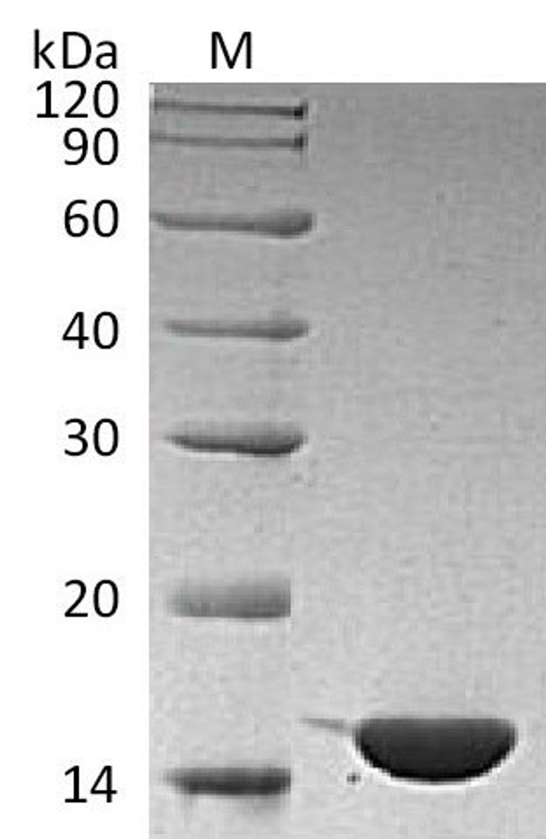 (Tris-Glycine gel) Discontinuous SDS-PAGE (reduced) with 5% enrichment gel and 15% separation gel.
