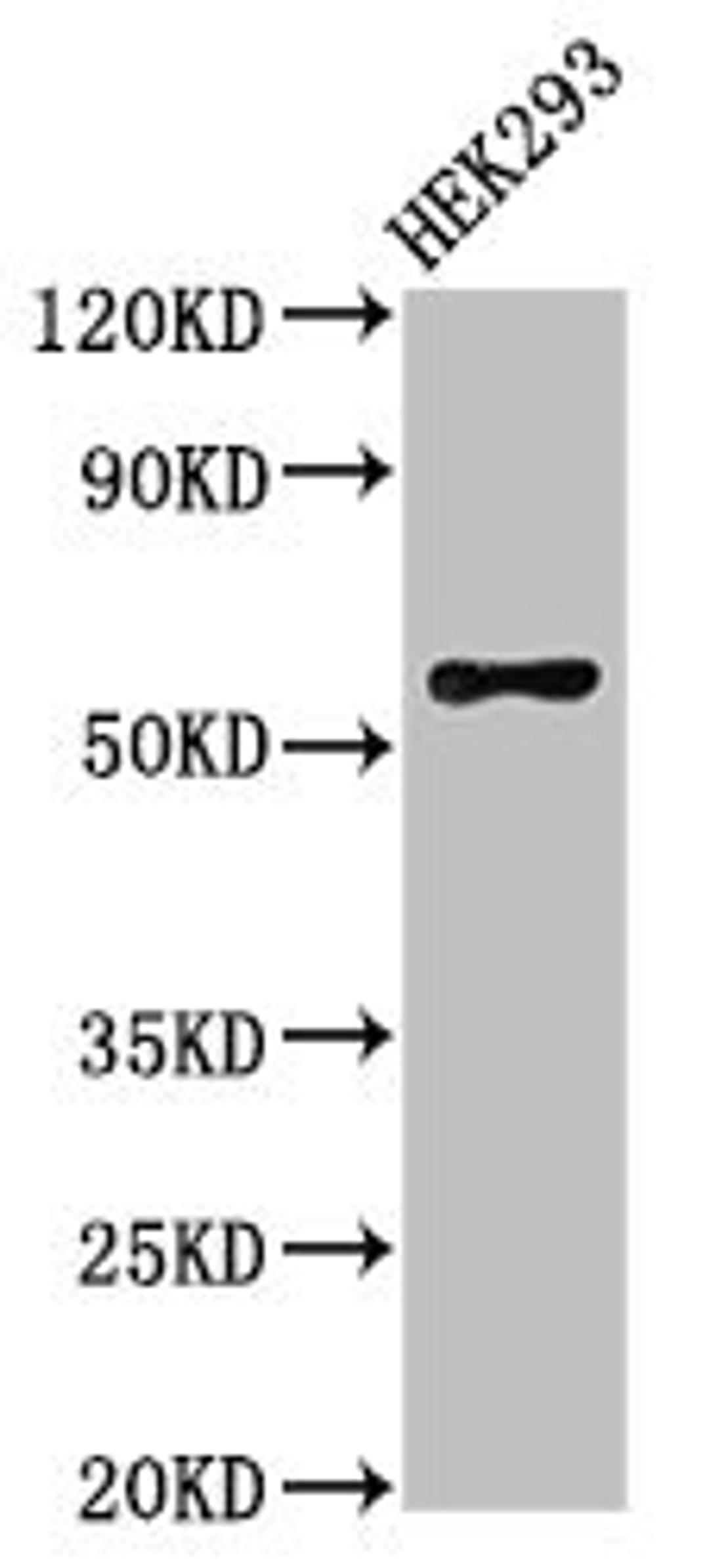 Western Blot. Positive WB detected in: HEK293 whole cell lysate. All lanes: RBPJL antibody at 3µg/ml. Secondary. Goat polyclonal to rabbit IgG at 1/50000 dilution. Predicted band size: 57 kDa. Observed band size: 57 kDa