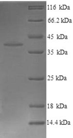 (Tris-Glycine gel) Discontinuous SDS-PAGE (reduced) with 5% enrichment gel and 15% separation gel.