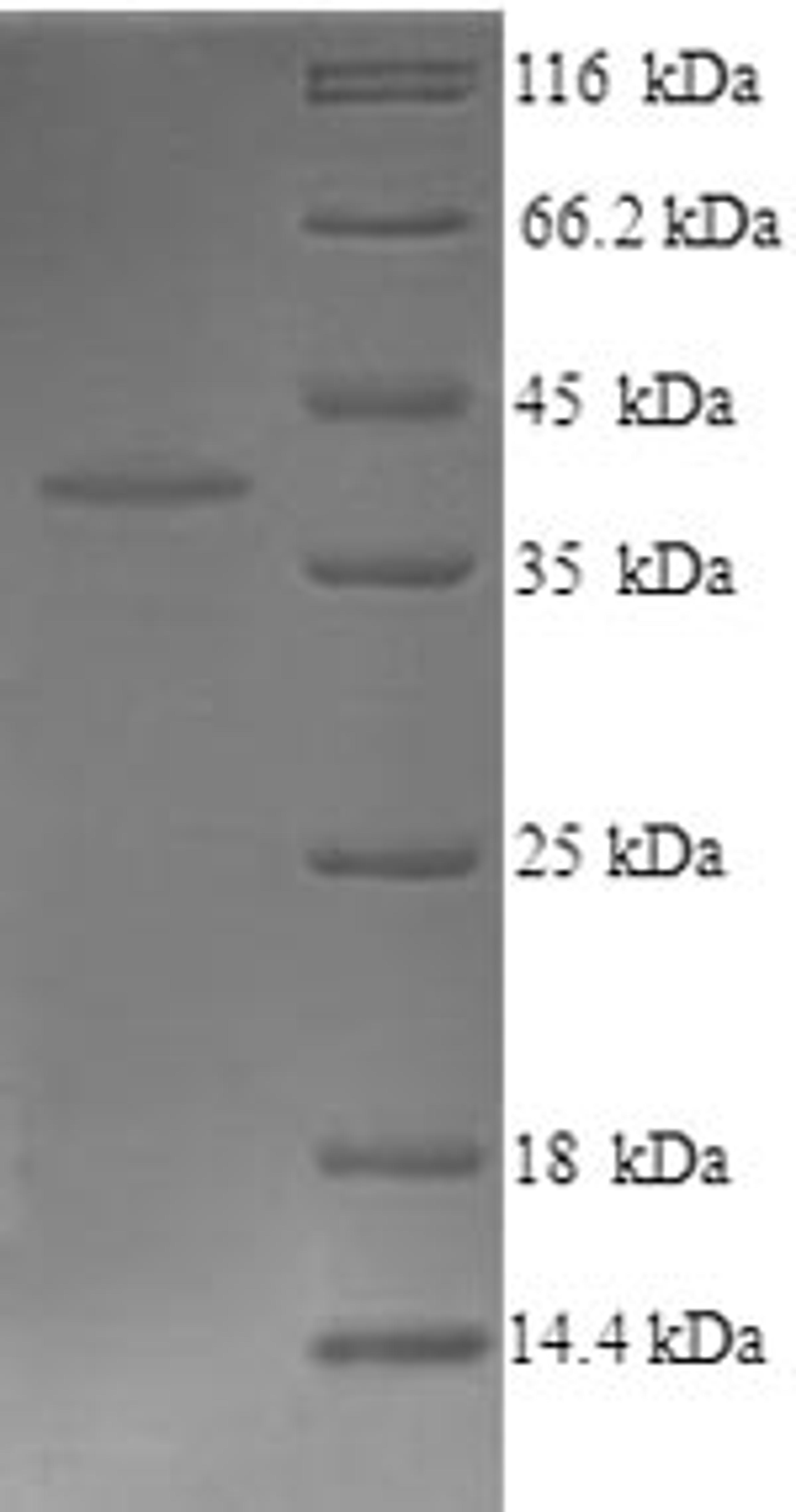 (Tris-Glycine gel) Discontinuous SDS-PAGE (reduced) with 5% enrichment gel and 15% separation gel.