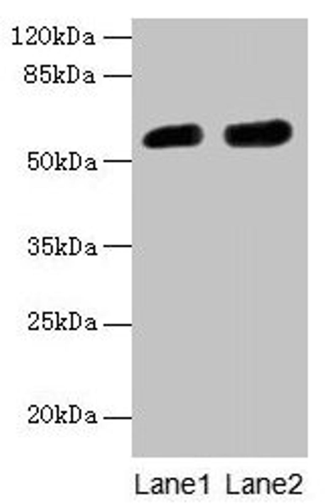 Western blot. All lanes: CBX2 antibody at 6µg/ml. Lane 1: A431 whole cell lysate. Lane 2: Mouse heart tissue. Secondary. Goat polyclonal to rabbit IgG at 1/10000 dilution. Predicted band size: 57, 24 kDa. Observed band size: 57 kDa