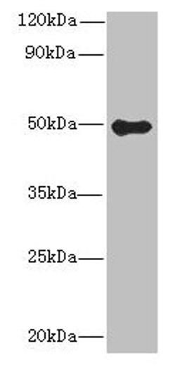 Western blot. All lanes: GSDMB antibody at 8µg/ml + Colo320 whole cell lysate. Secondary. Goat polyclonal to rabbit IgG at 1/10000 dilution. Predicted band size: 47, 46, 48, 19 kDa. Observed band size: 47 kDa