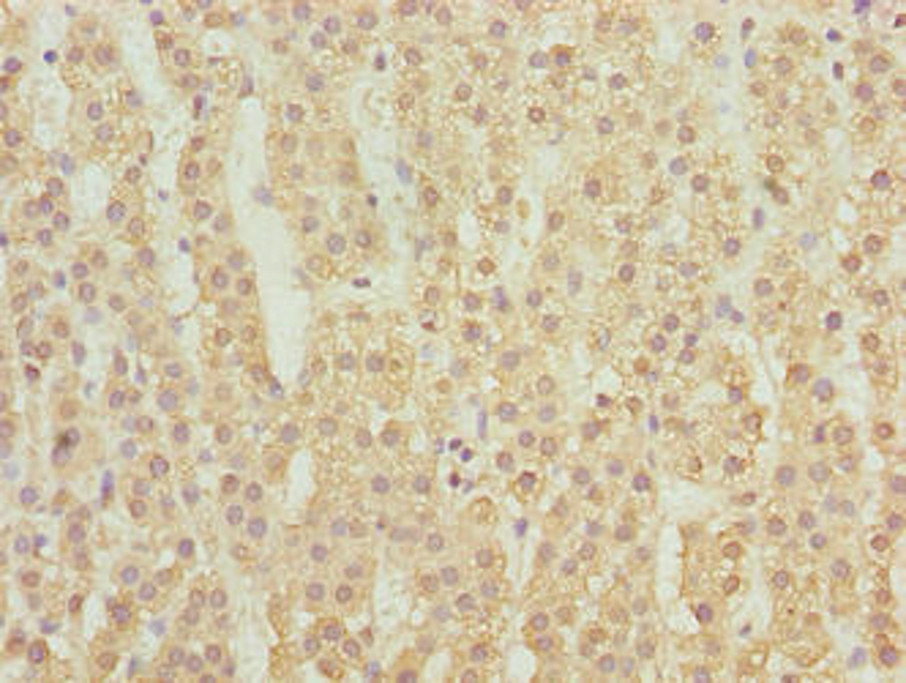 Immunohistochemistry of paraffin-embedded human adrenal gland tissue using CSB-PA863974LA01HU at dilution of 1:100