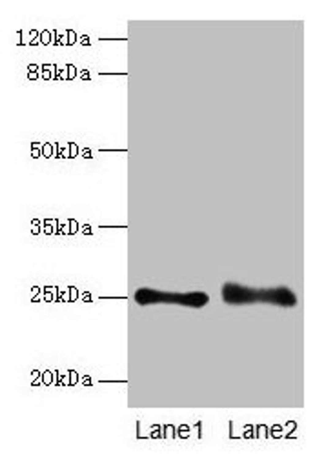Western blot. All lanes: RAB3B antibody at 4µg/ml. Lane 1: Mouse brain tissue. Lane 2: U87 whole cell lysate. Secondary. Goat polyclonal to rabbit IgG at 1/10000 dilution. Predicted band size: 25 kDa. Observed band size: 25 kDa