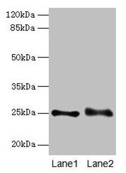 Western blot. All lanes: RAB3B antibody at 4µg/ml. Lane 1: Mouse brain tissue. Lane 2: U87 whole cell lysate. Secondary. Goat polyclonal to rabbit IgG at 1/10000 dilution. Predicted band size: 25 kDa. Observed band size: 25 kDa