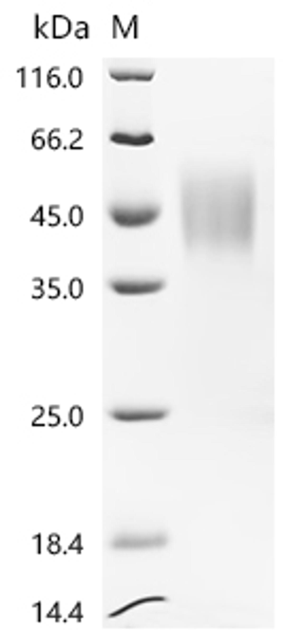 (Tris-Glycine gel) Discontinuous SDS-PAGE (reduced) with 5% enrichment gel and 15% separation gel.