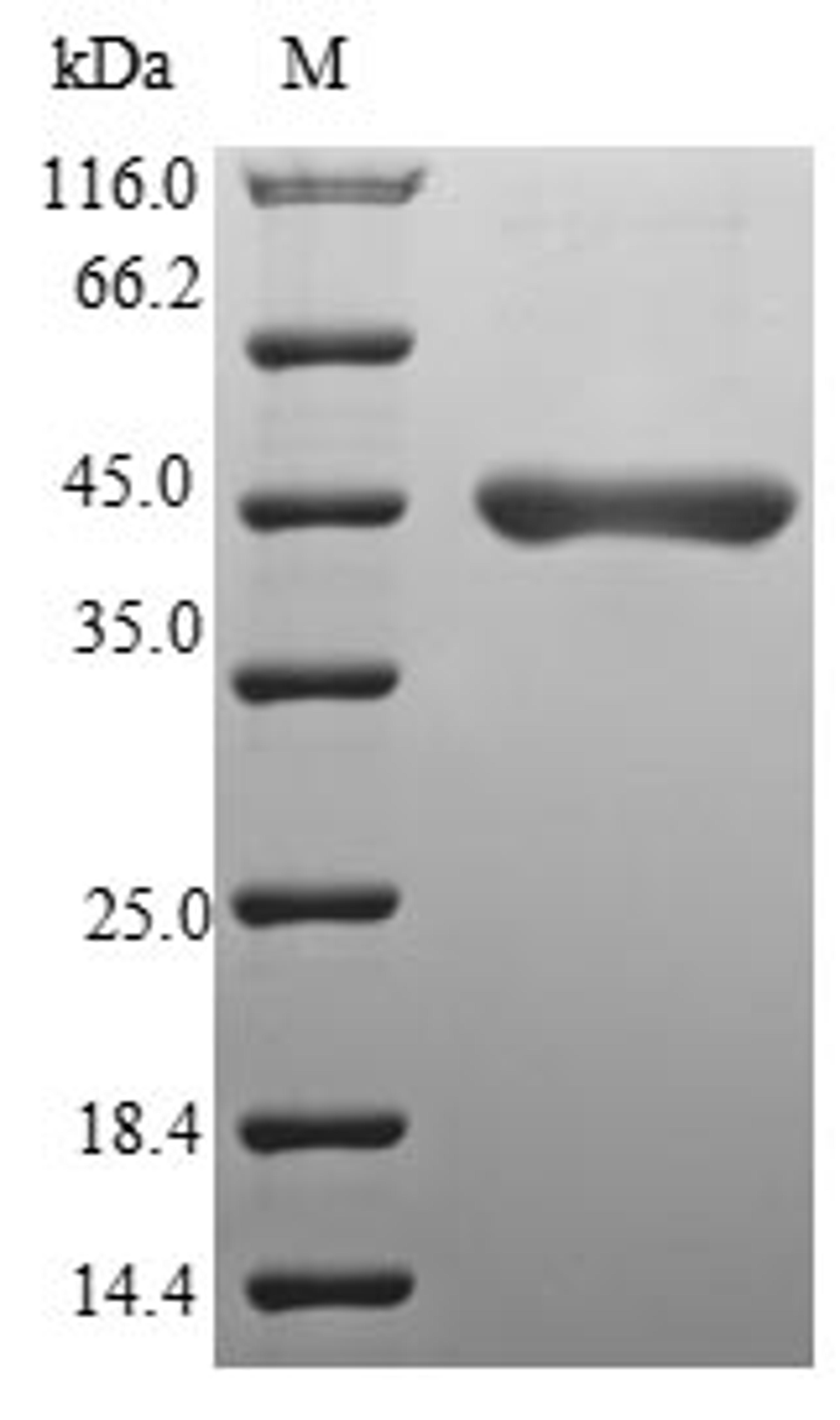 (Tris-Glycine gel) Discontinuous SDS-PAGE (reduced) with 5% enrichment gel and 15% separation gel.