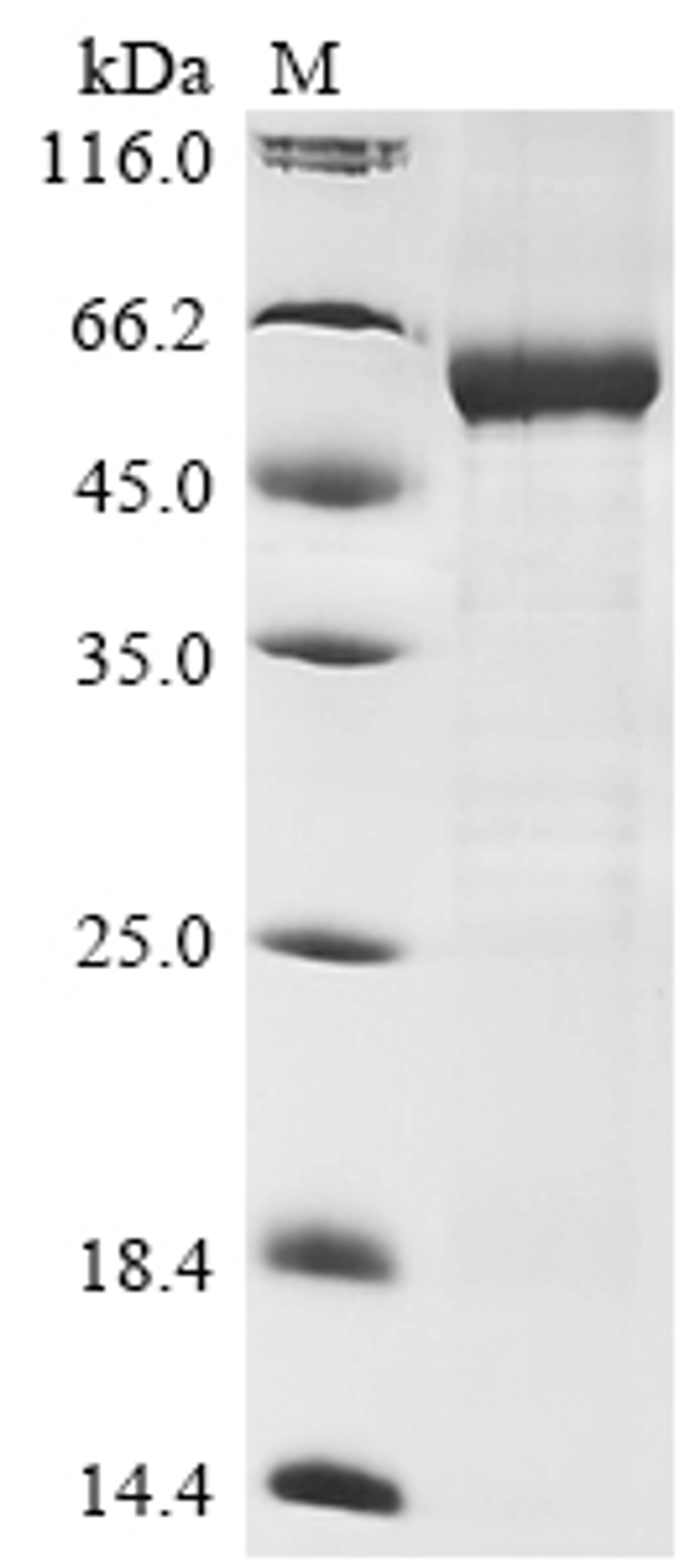 (Tris-Glycine gel) Discontinuous SDS-PAGE (reduced) with 5% enrichment gel and 15% separation gel.