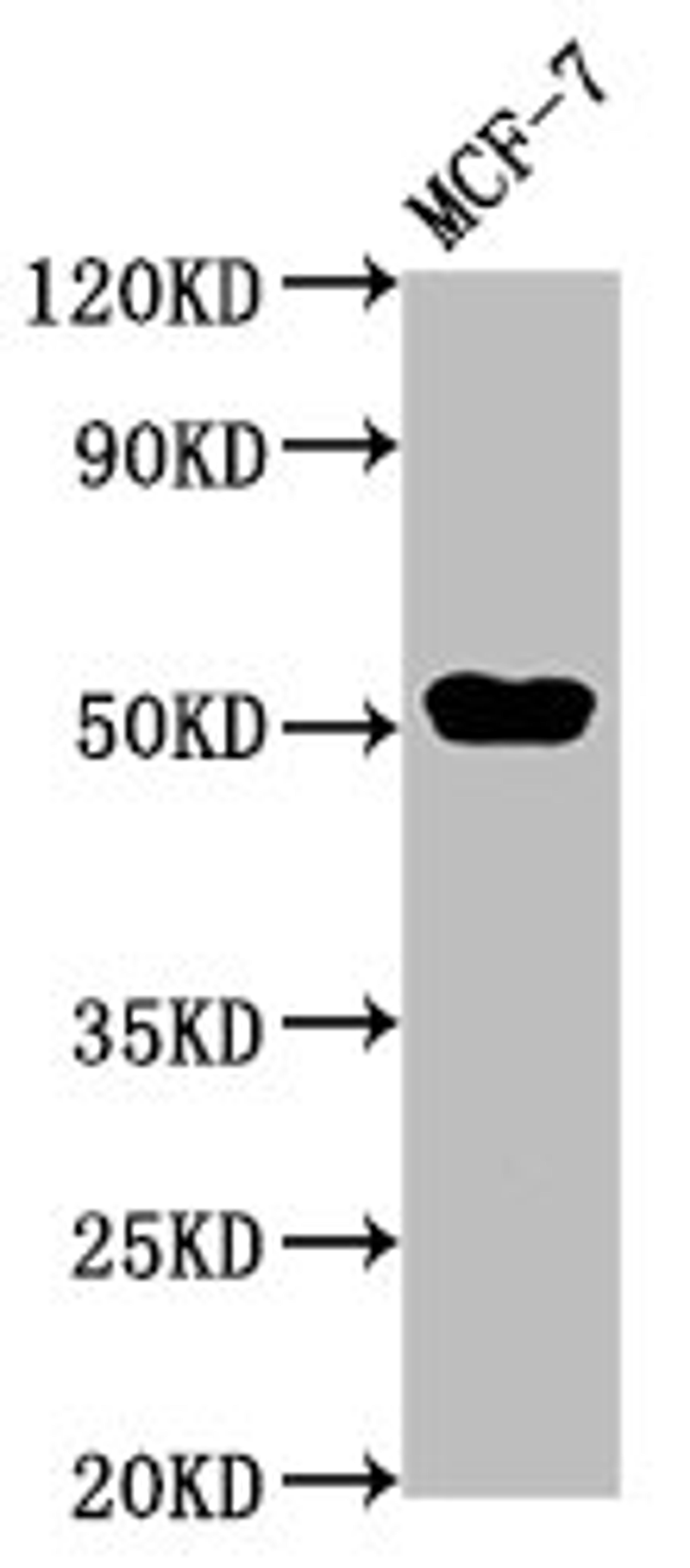 Western Blot. Positive WB detected in: MCF-7 whole cell lysate. All lanes: CCDC6 antibody at 3µg/ml. Secondary. Goat polyclonal to rabbit IgG at 1/50000 dilution. Predicted band size: 54 kDa. Observed band size: 54 kDa